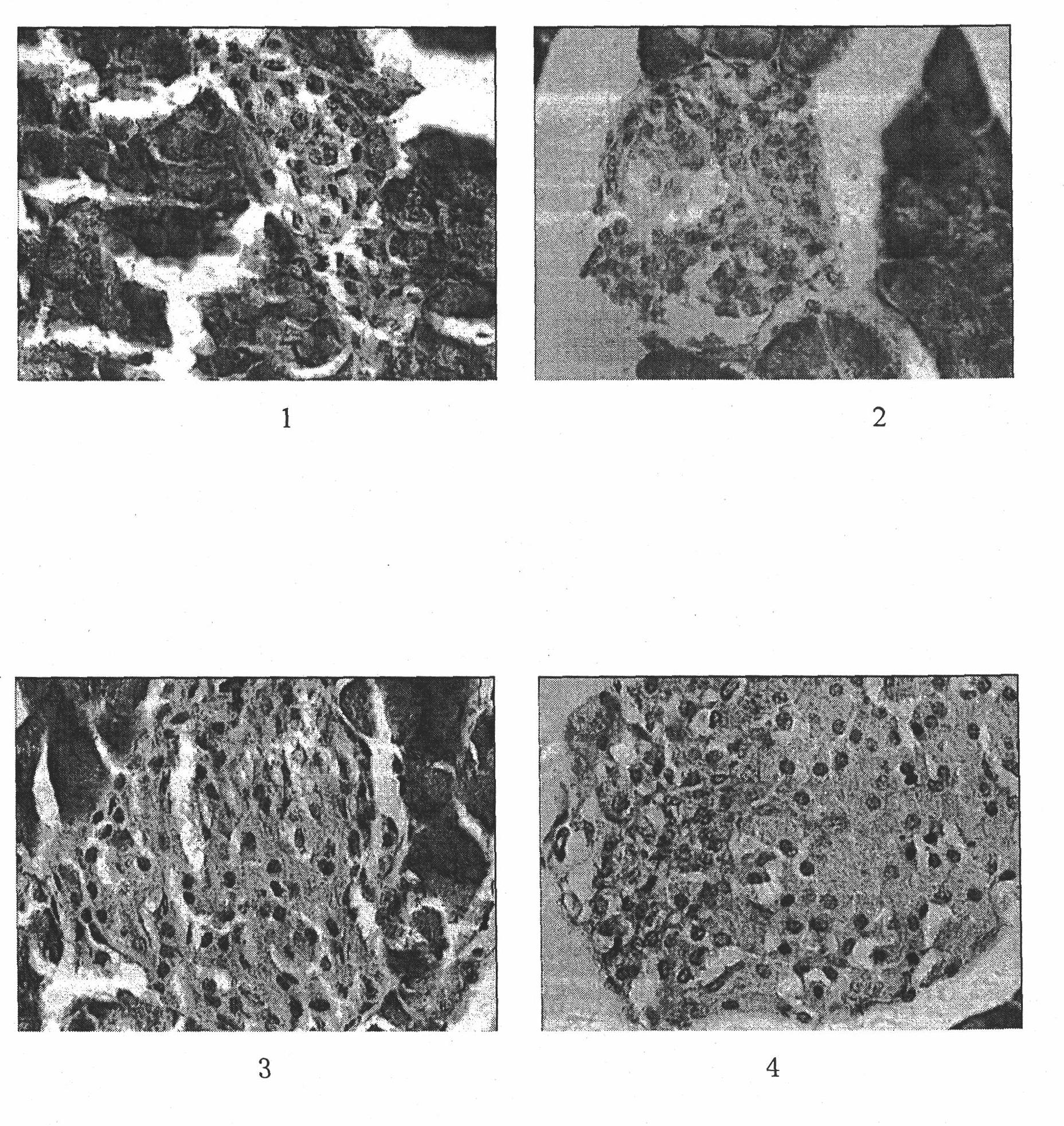 Jiantangcha (blood glucose benefiting tea) capsule for adjunctively reducing blood glucose and improving symptoms of diabetes and preparation method thereof