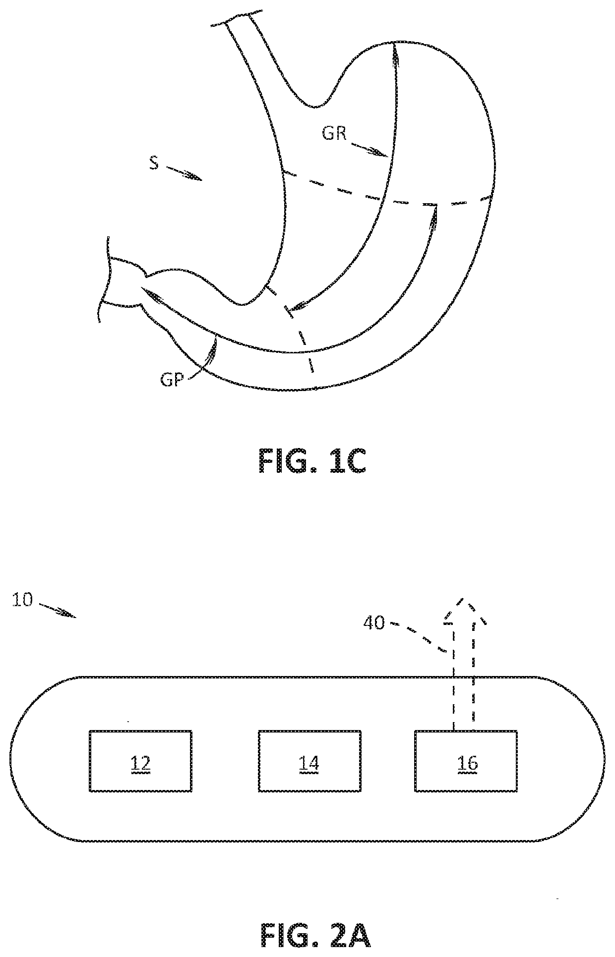 Devices, systems, and methods for delivering therapeutic agents into a stomach wall