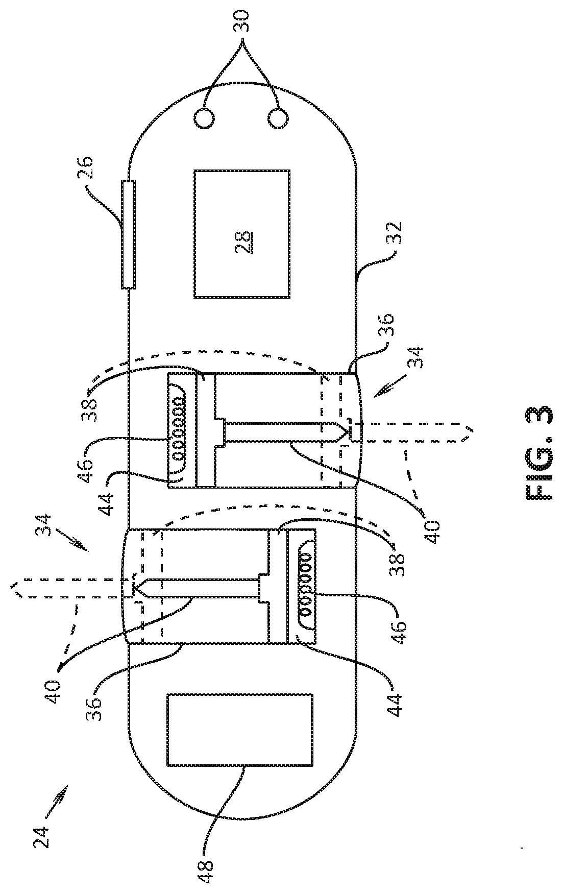 Devices, systems, and methods for delivering therapeutic agents into a stomach wall