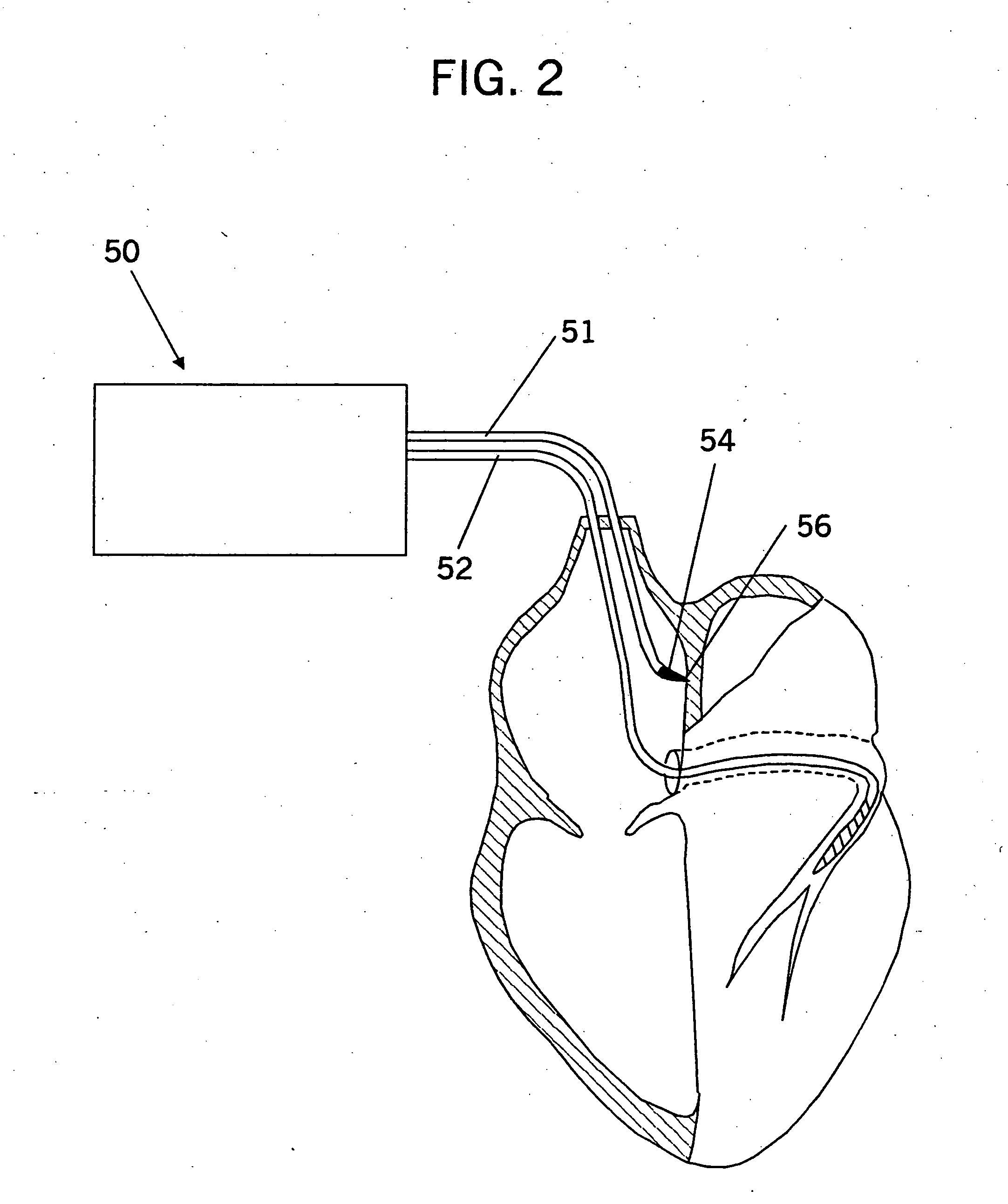 Inter-atrial septum or superior vena cava electrodes for atrial defibrillation