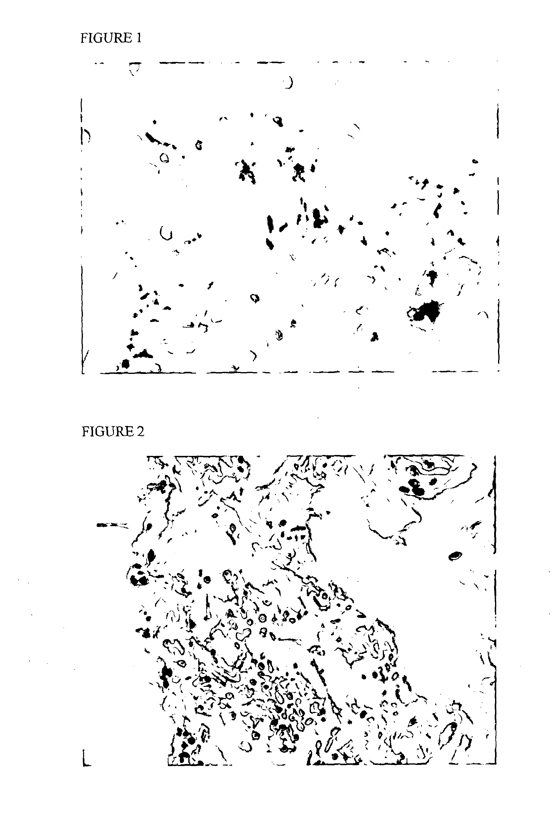 Methods for detecting of benign conditions