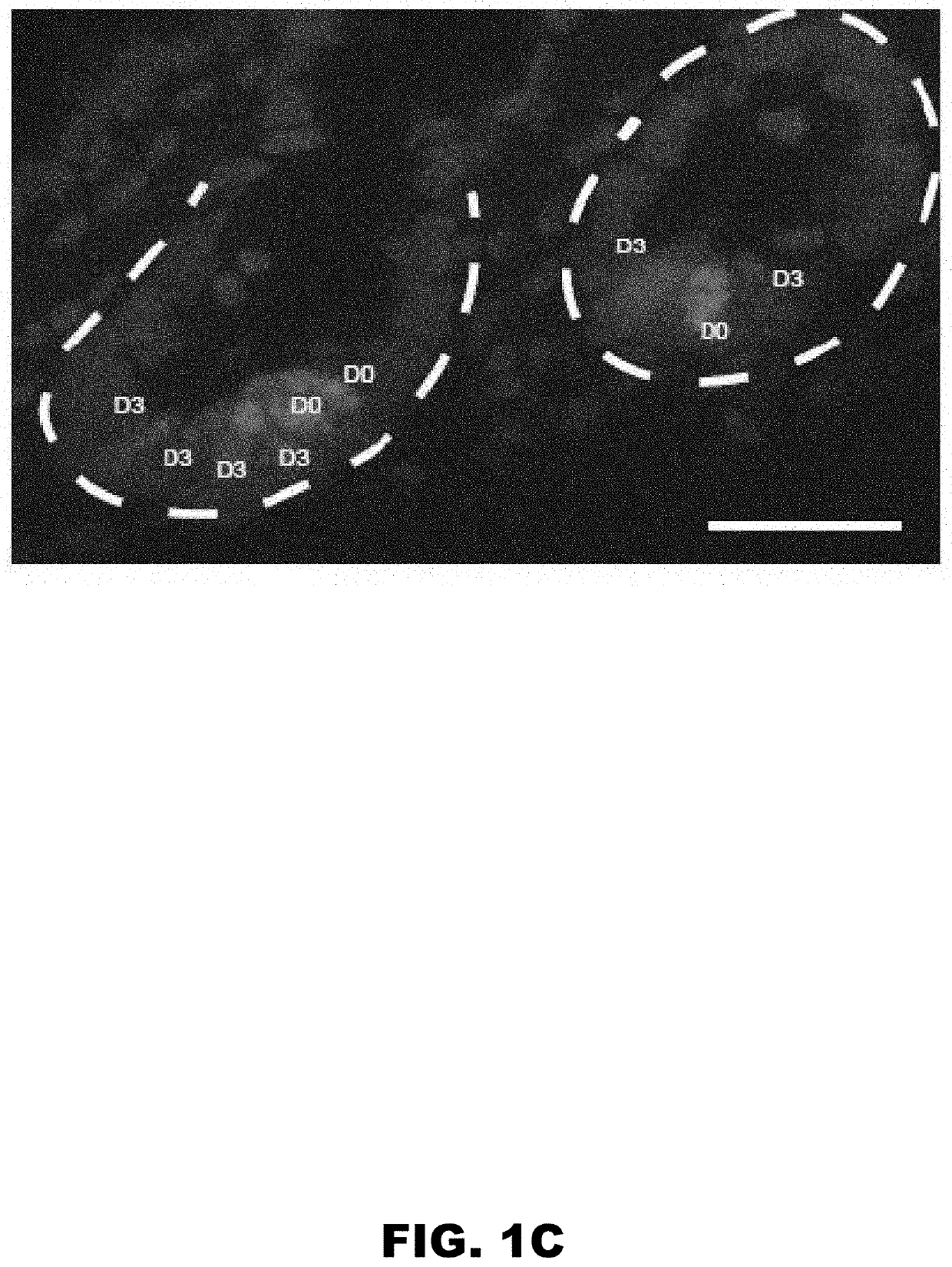 Methods for prognosing crohn's disease comprising human defensin 5 (HD5)