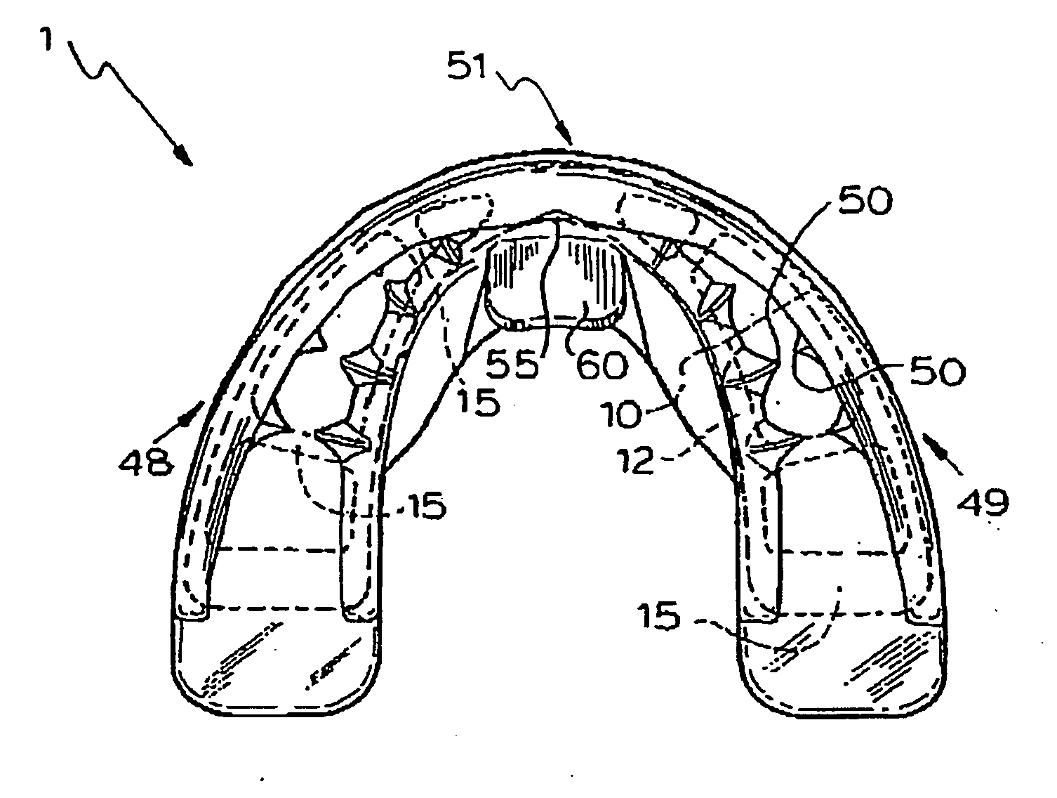 Orthodontic appliance