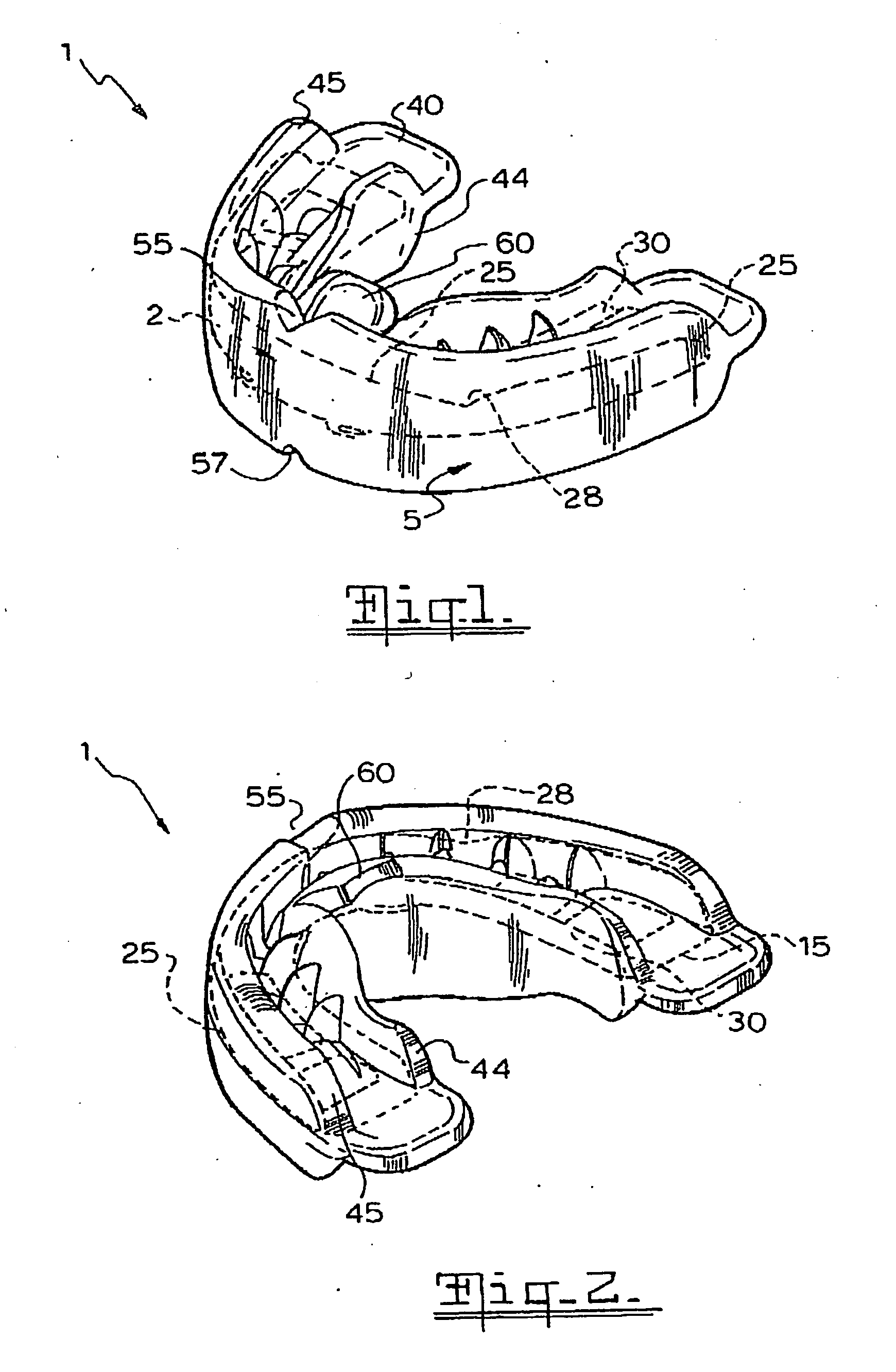 Orthodontic appliance