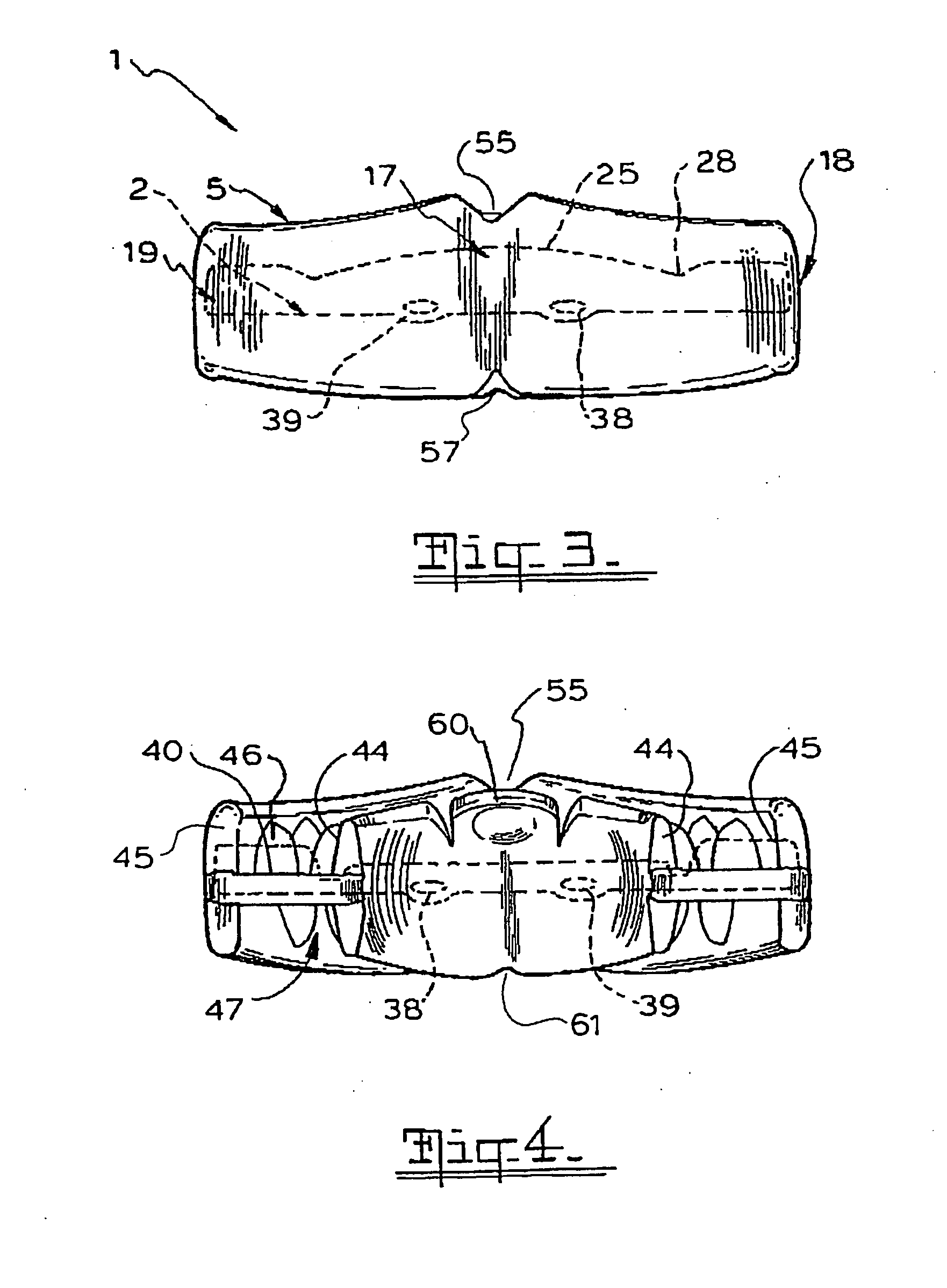 Orthodontic appliance