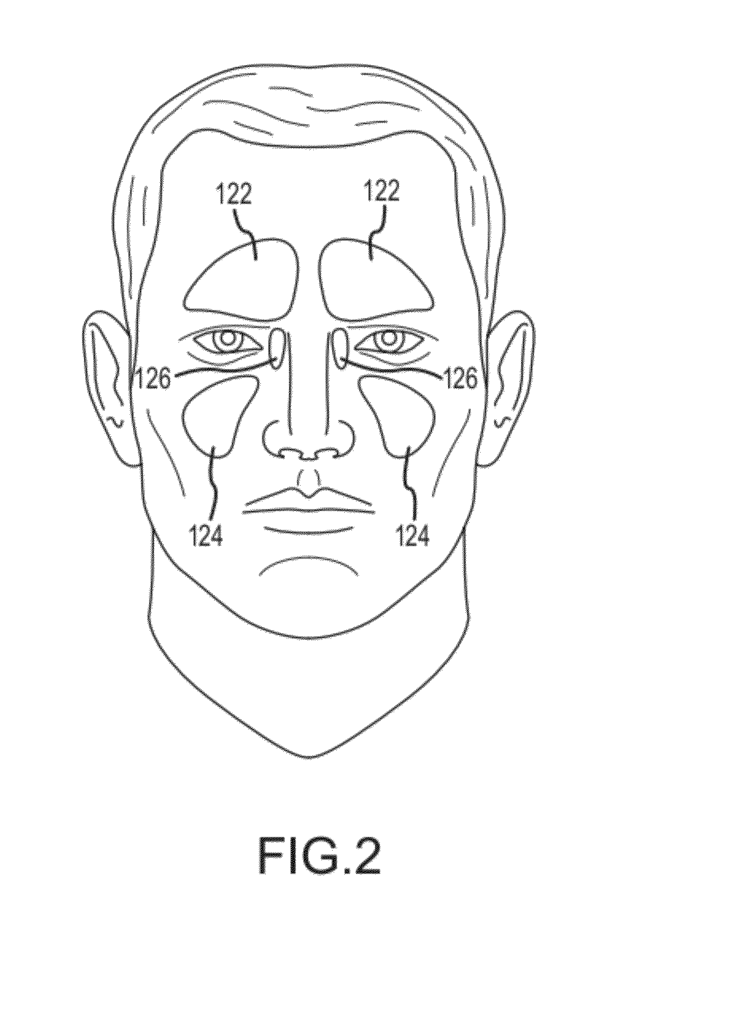 Implant device, tool, and methods relating to treatment of paranasal sinuses