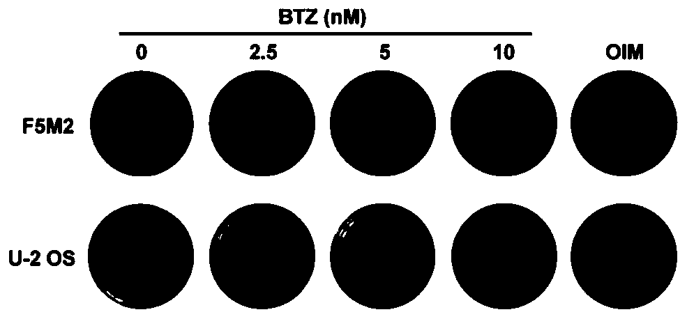 Application of bortezomib in preparation of medicine for treating osteosarcoma