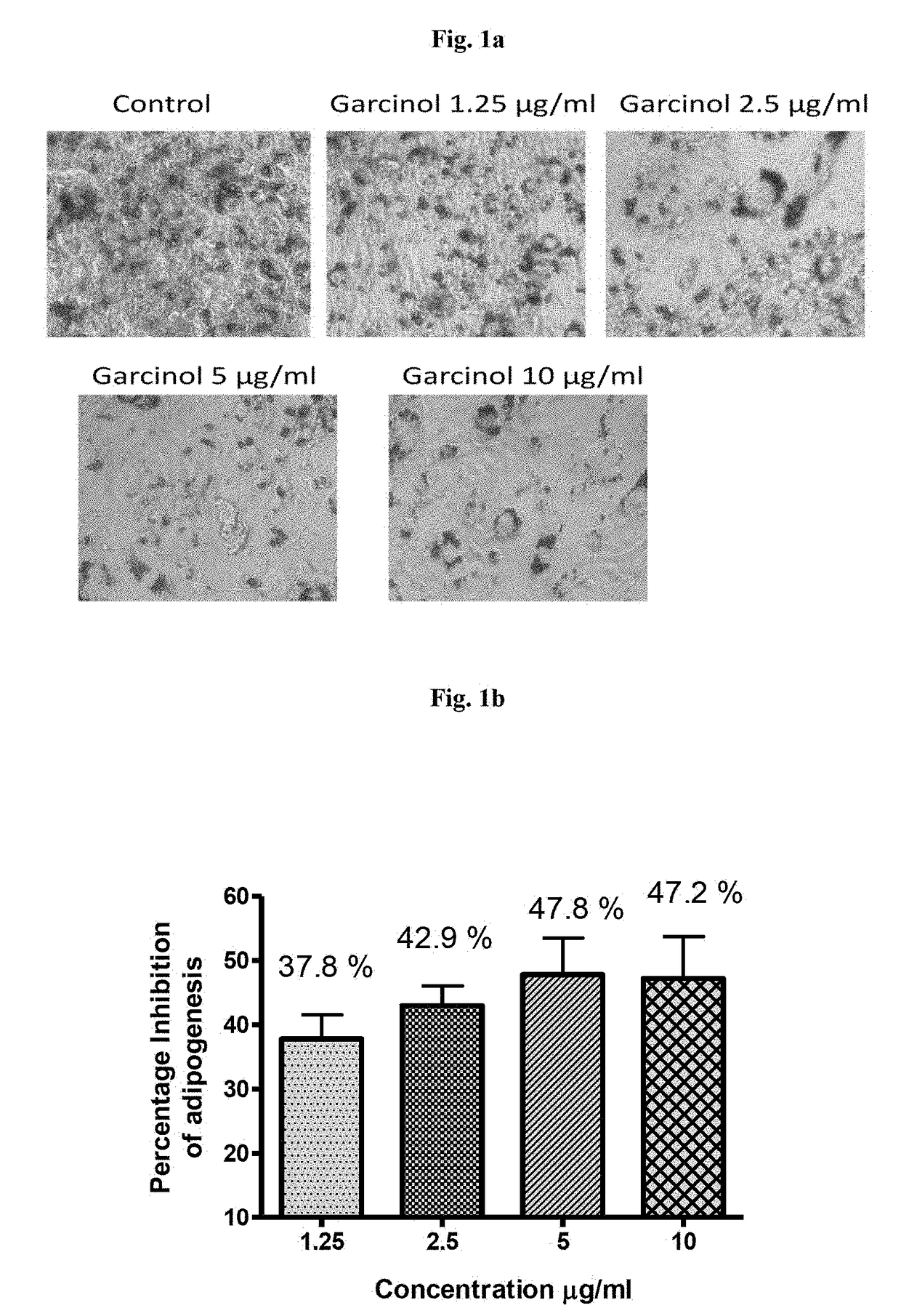 Anti-obesity potential of garcinol