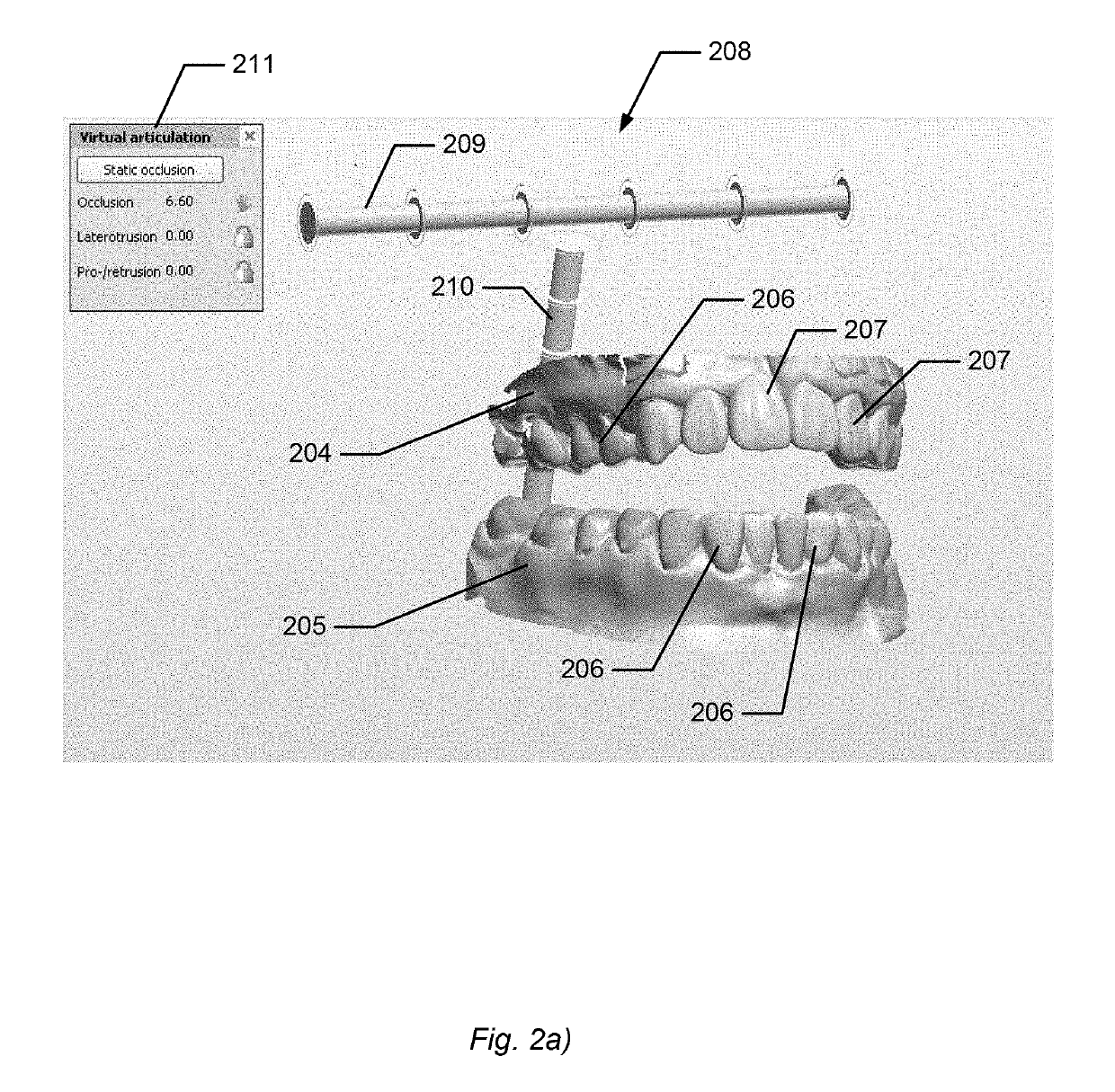 Dynamic virtual articulator for simulating occlusion of teeth