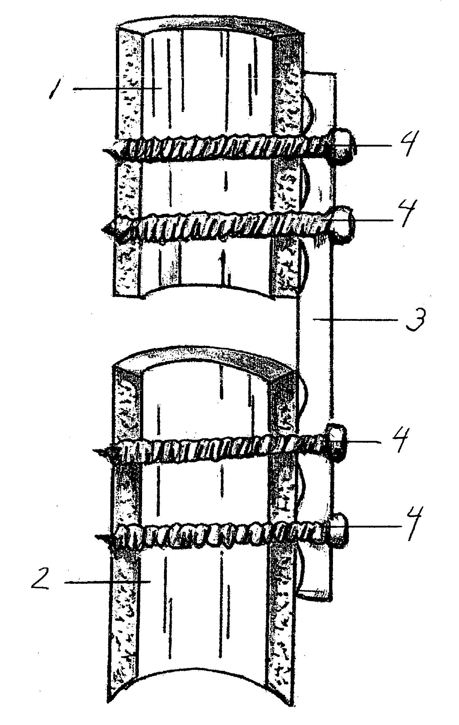 Bone plating system for treatment of hip fractures