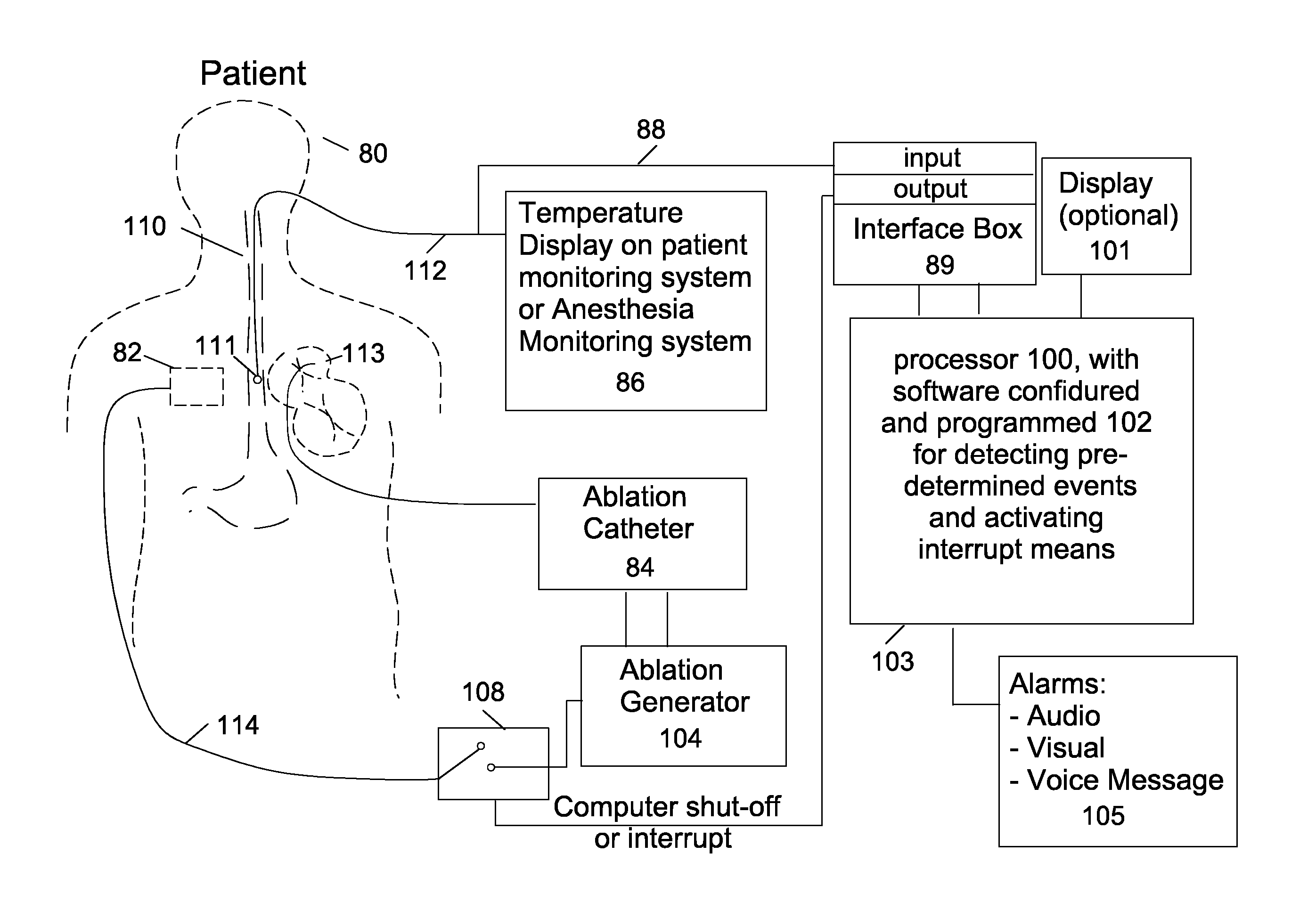 Methods and systems of temperature based alarms, esophageal cooling and/or automatic interrupt (shut-off) during a cardic ablation procedure