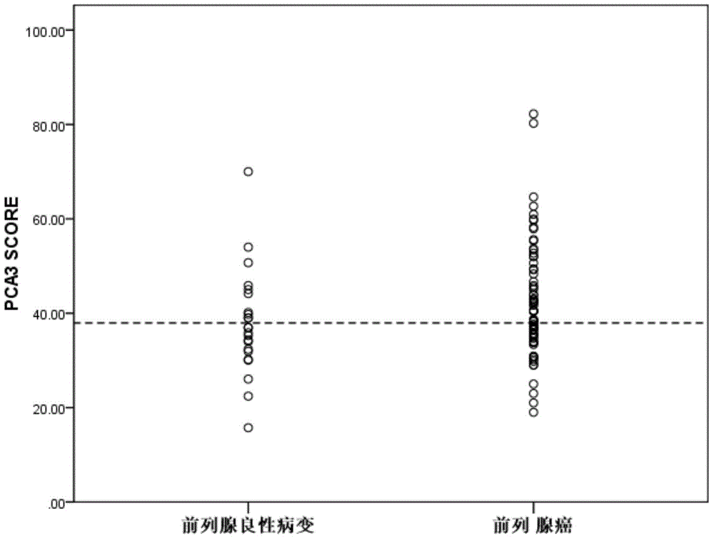 Urine detection kit for prostate cancer and application thereof