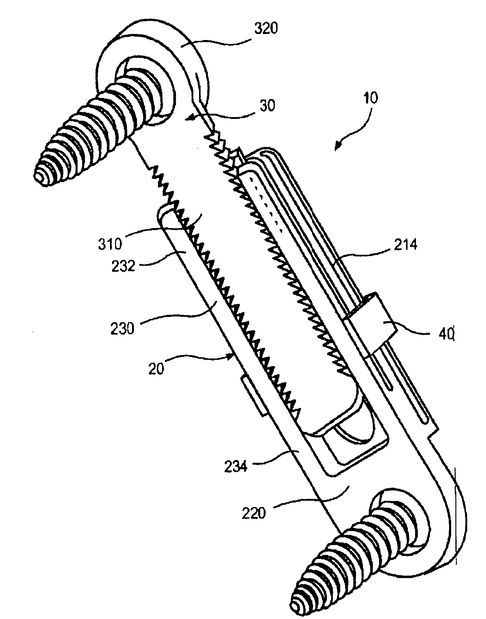 Ratcheting epiphysiodesis plate