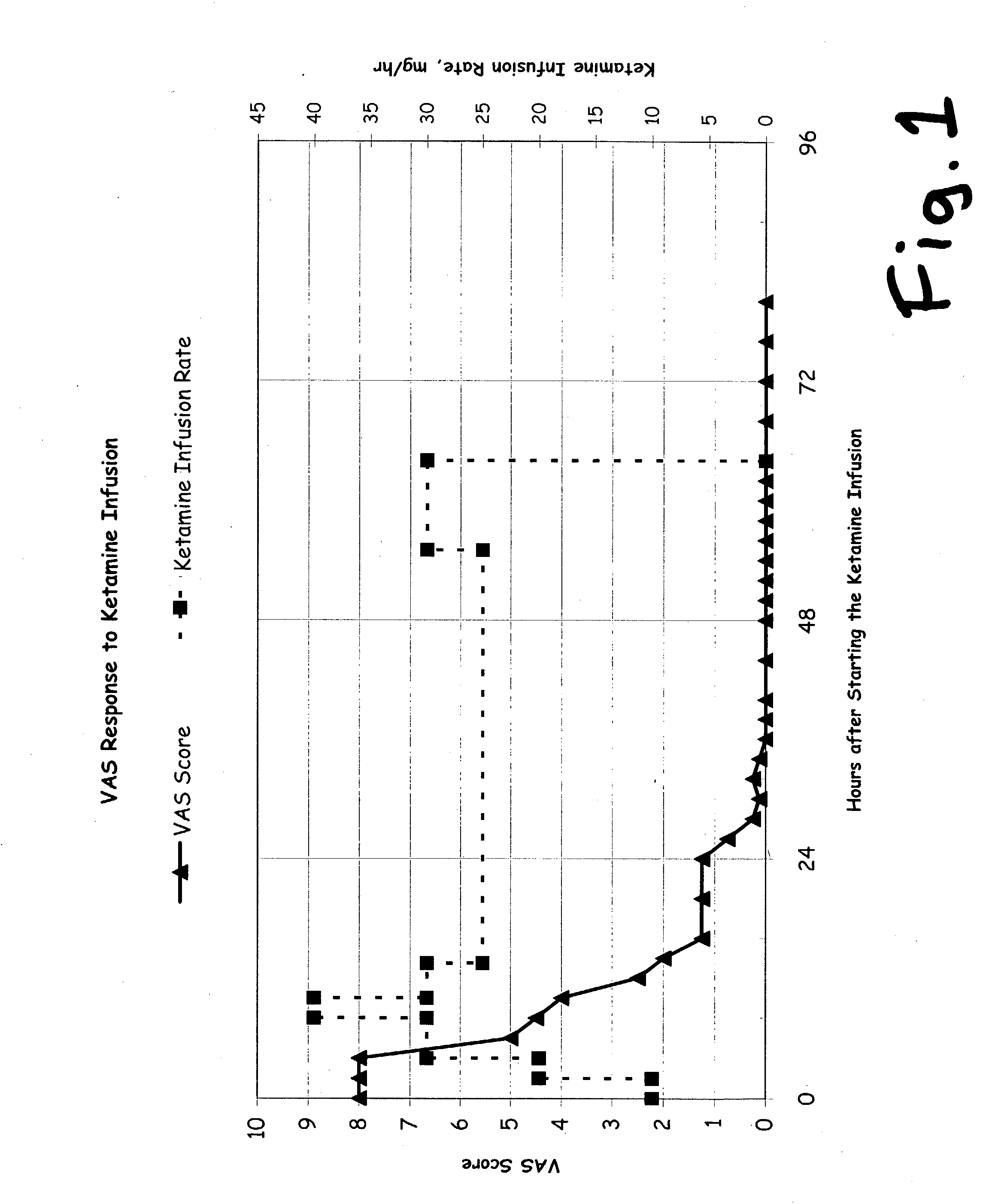 Prolonged administration of NMDA antagonist and safener drug to alter neuropathic pain condition