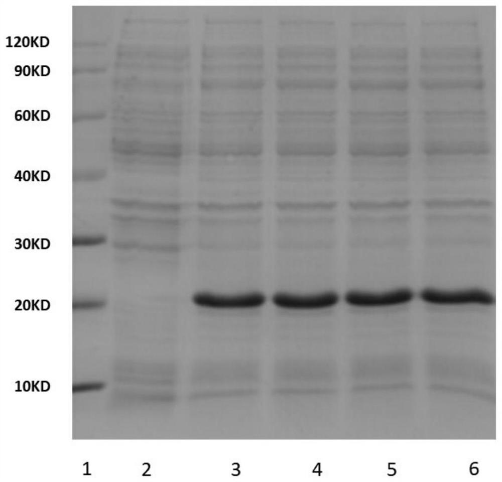 A kind of recombinant retinol binding protein 4 and its preparation method and application