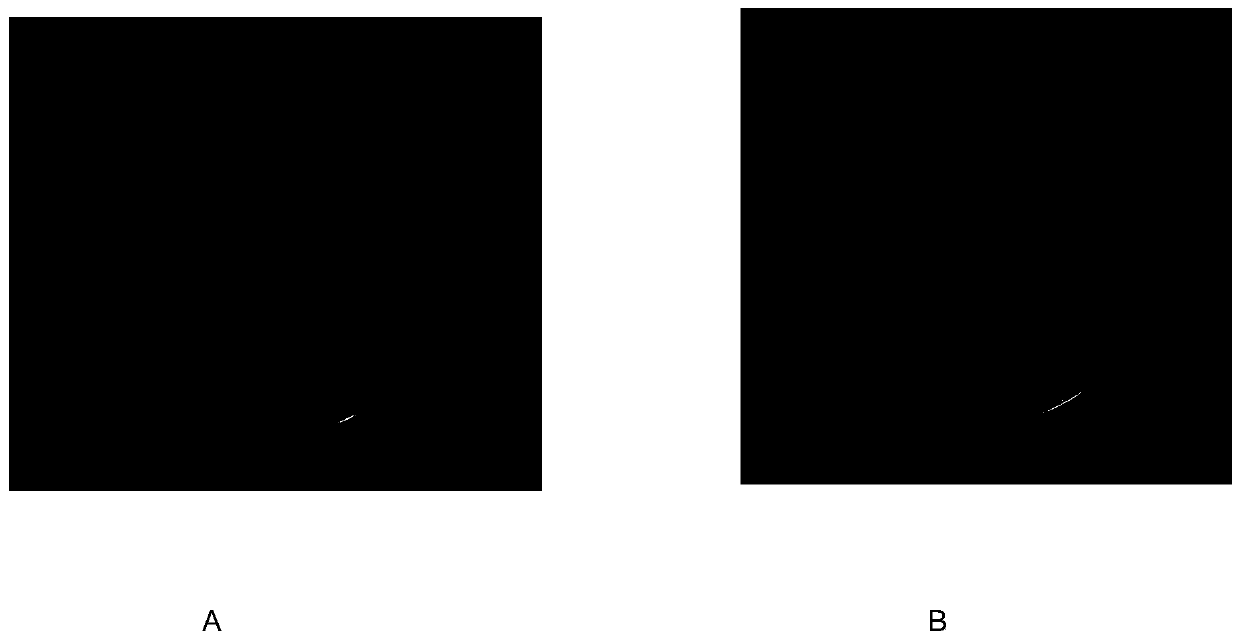 Ultralow-temperature freezing and sealing type preservation method