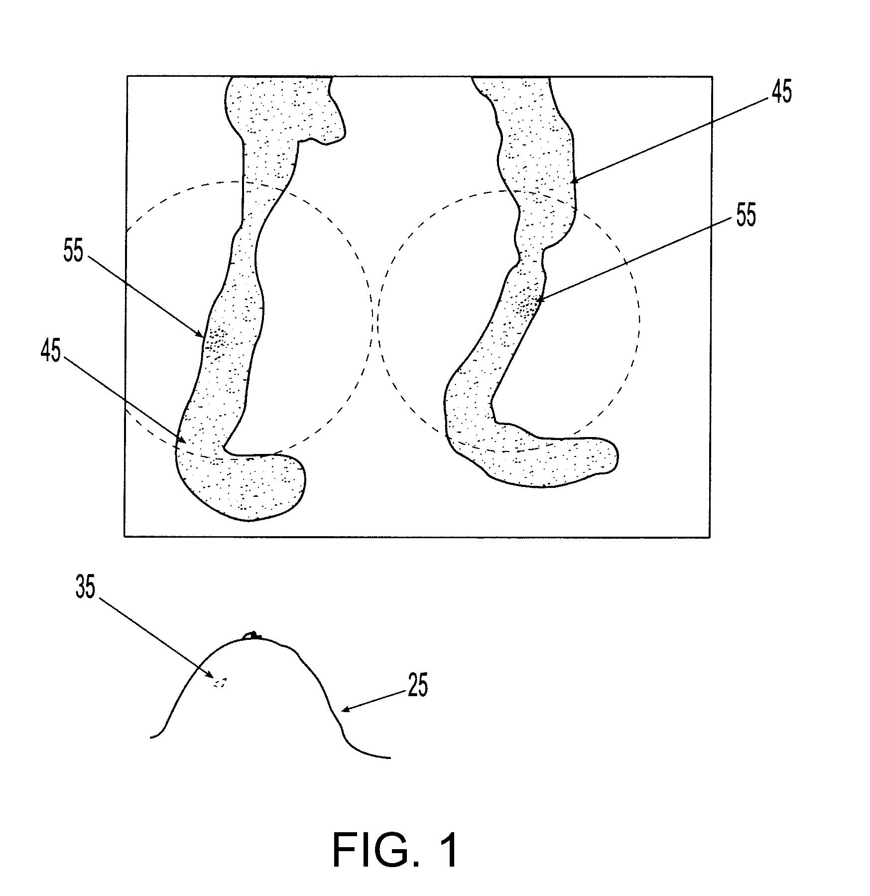 System and apparatus for rapid stereotactic breast biopsy analysis