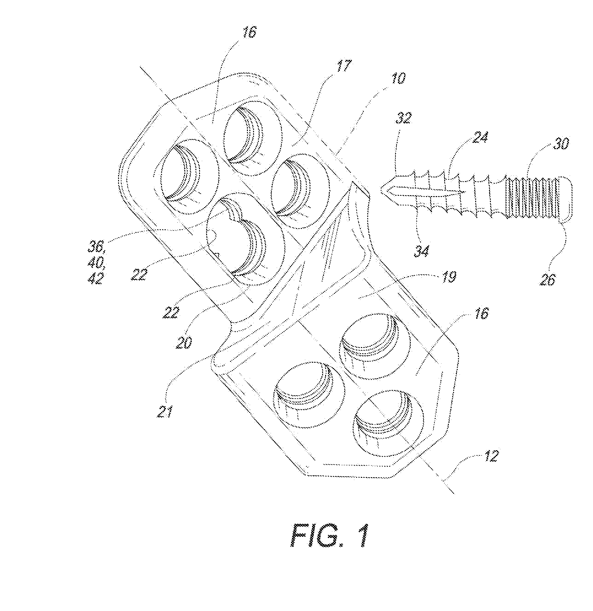 Locking tpo plate and method of use