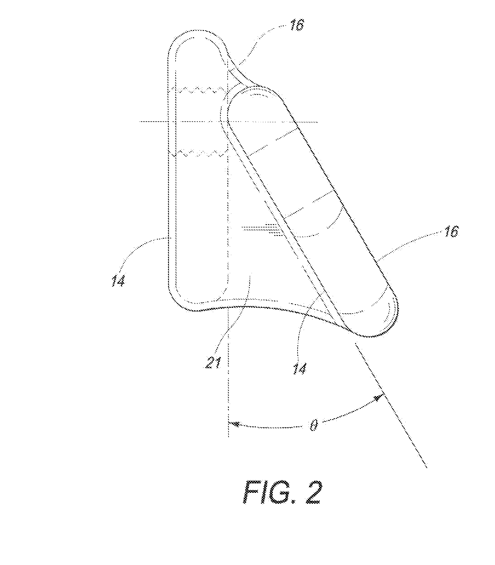 Locking tpo plate and method of use