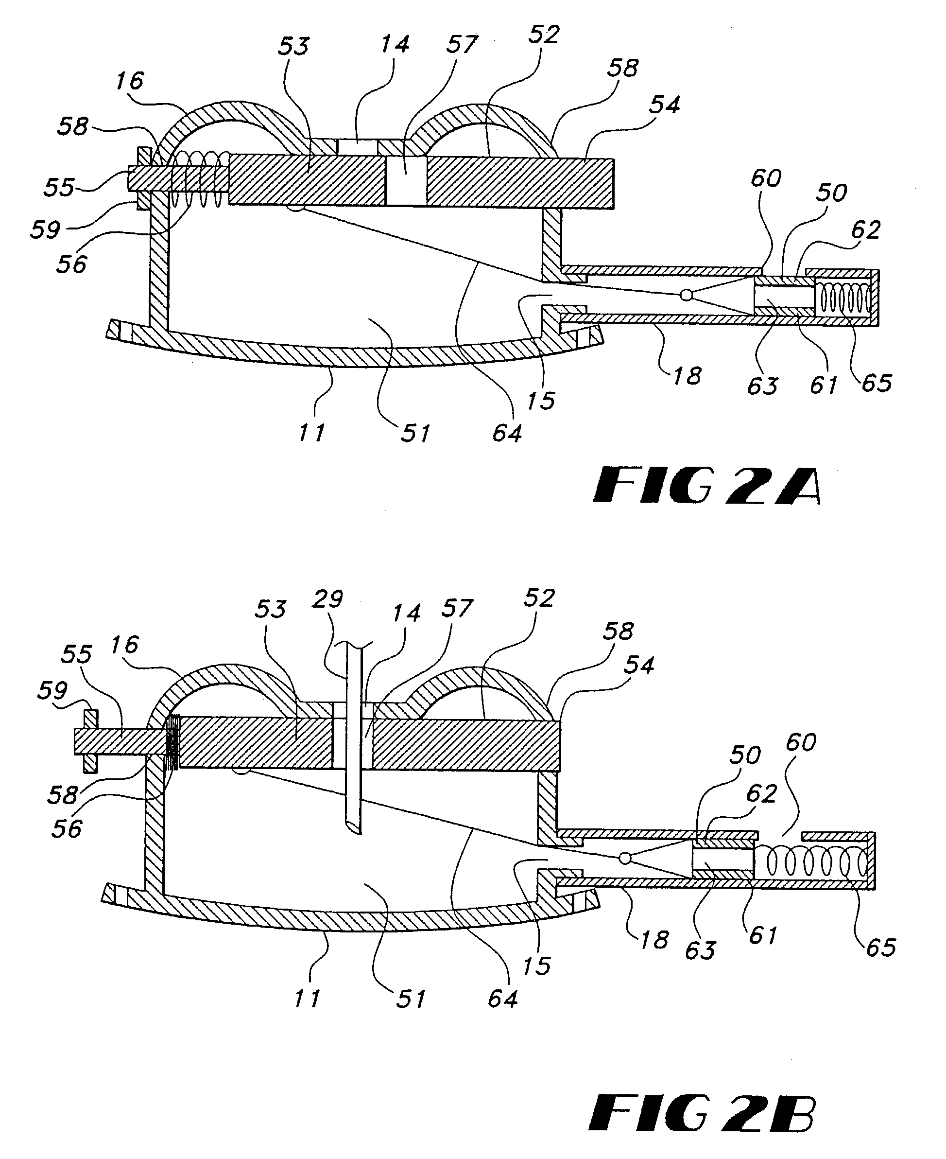 Implantable vascular access device