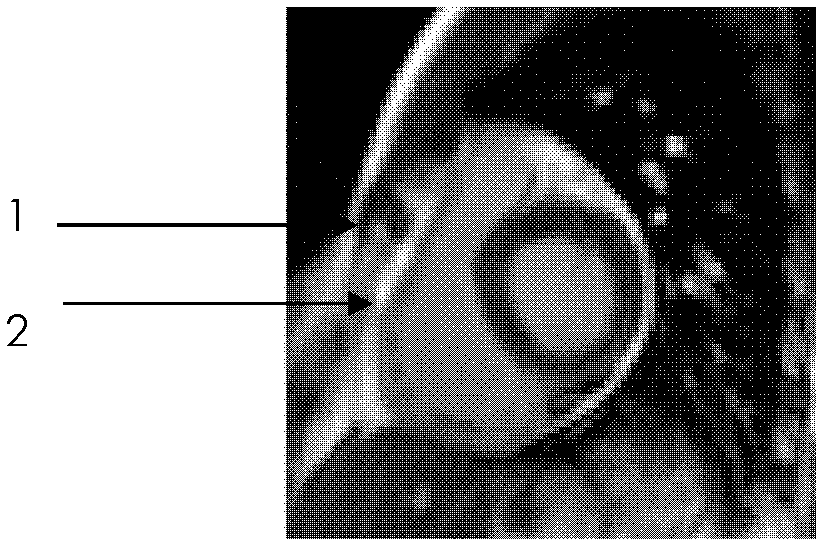 Method for segmenting cardiac nuclear magnetic resonance image