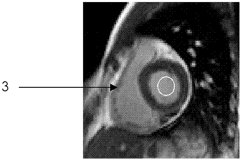 Method for segmenting cardiac nuclear magnetic resonance image