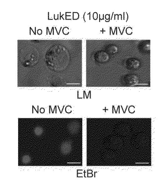 Leukotoxin e/d as a new Anti-inflammatory agent and microbicide