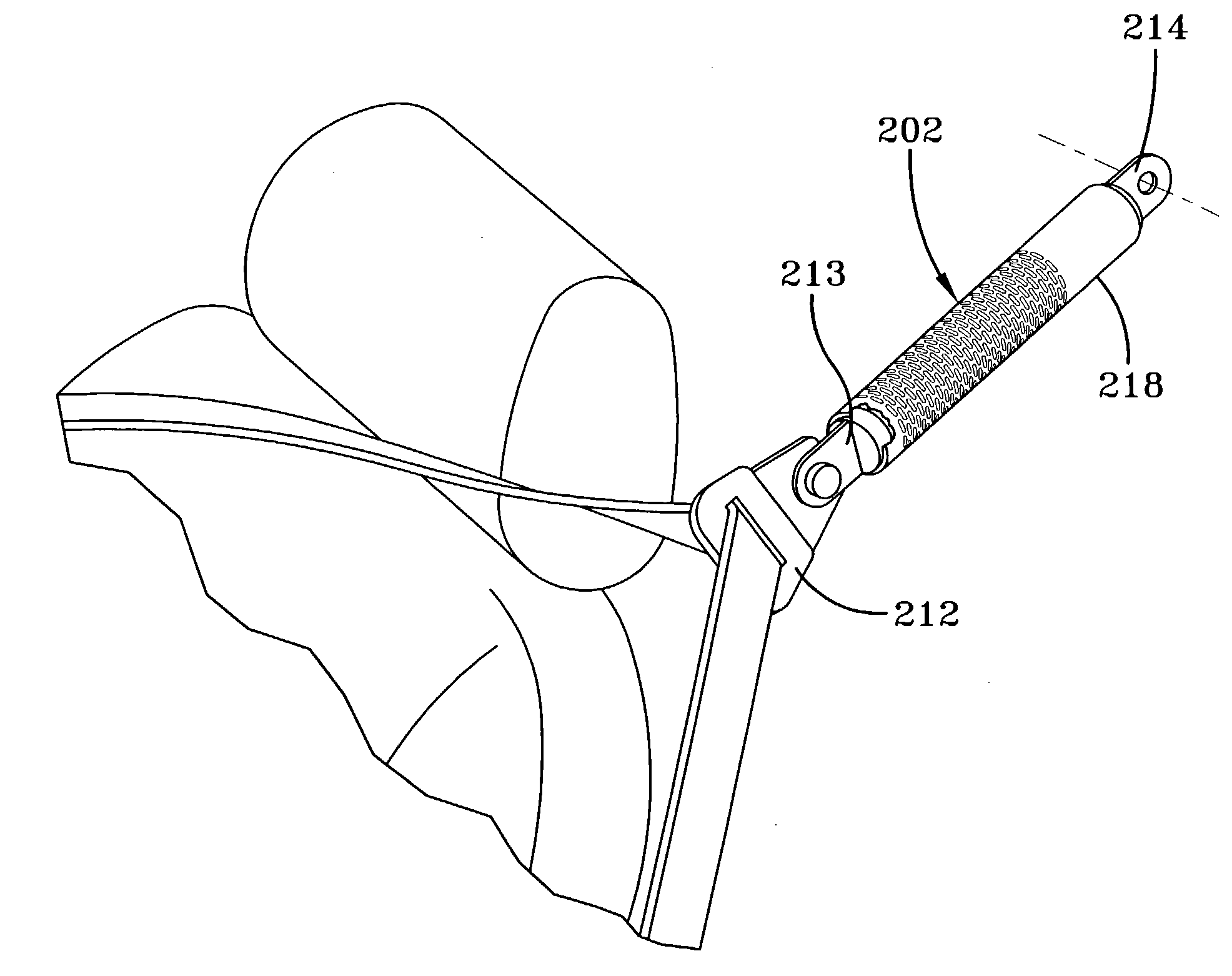 Load limiting structure for vehicle occupant restraint system