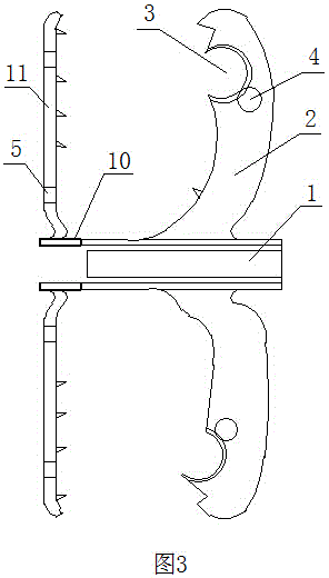 Spine board dynamic stabilizing system