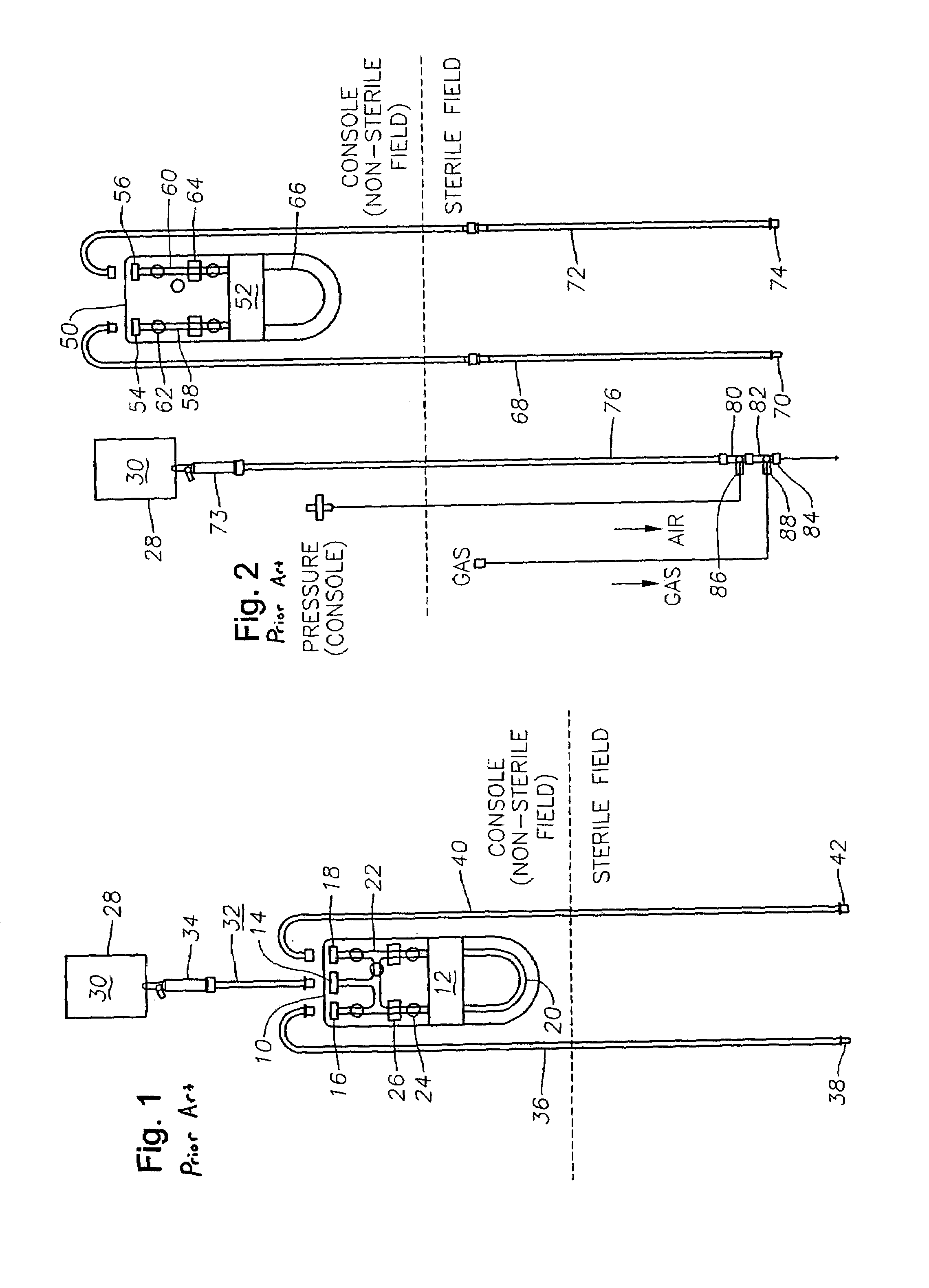 Surgical cassette and consumables for combined opthalmic surgical procedure