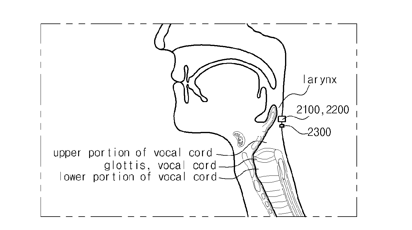 Device for supplementing voice including sensing unit and method for controlling the same