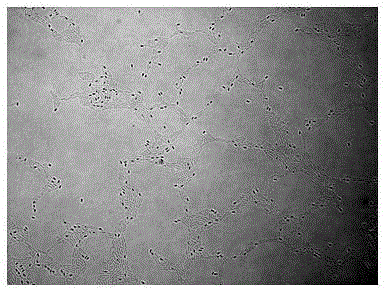 Tumorous stem mustard root nodule ndophytic bacteria GJ-06, clubroot preventing and treating agent containing same and application