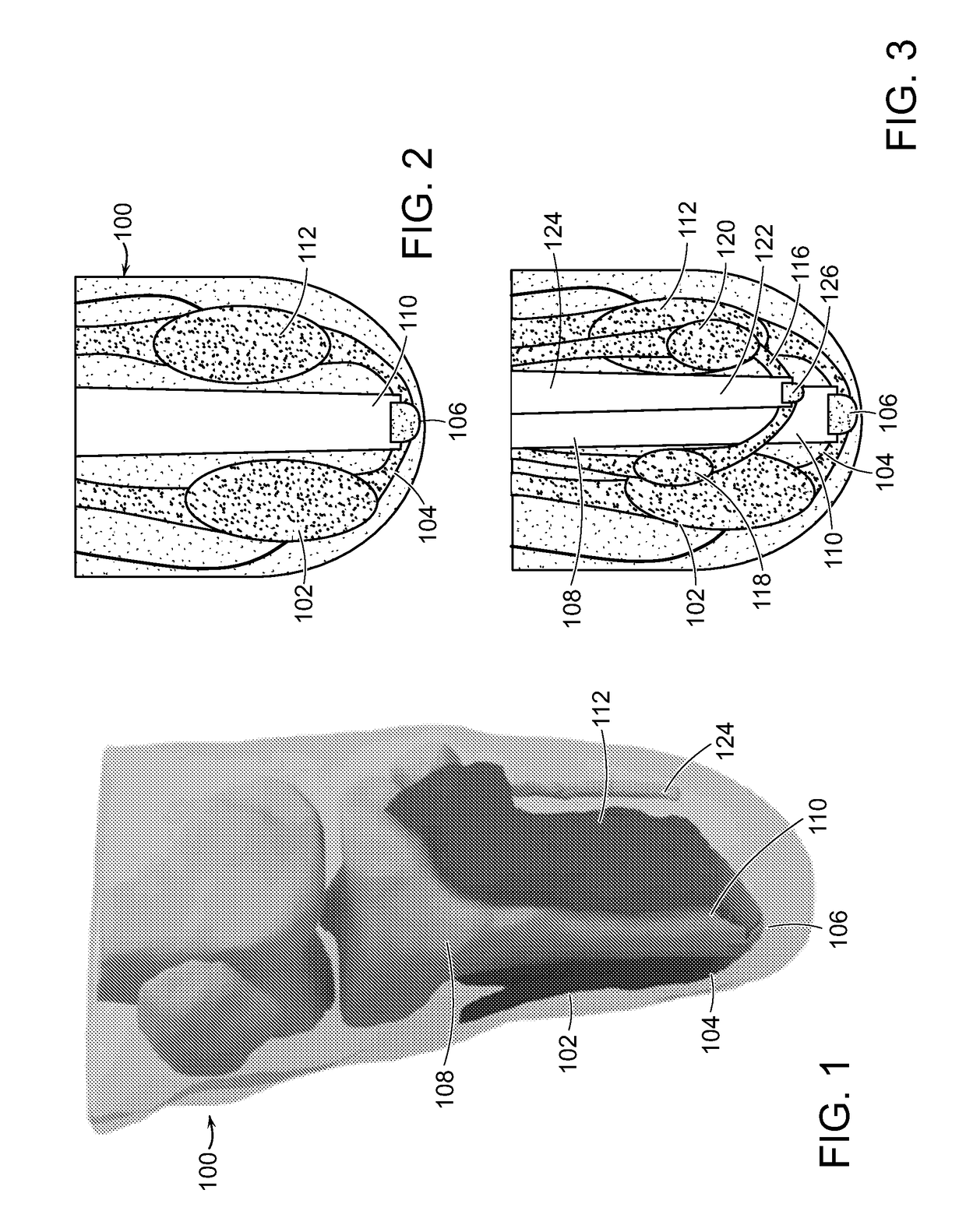 Method And System For Providing Proprioceptive Feedback And Functionality Mitigating Limb Pathology