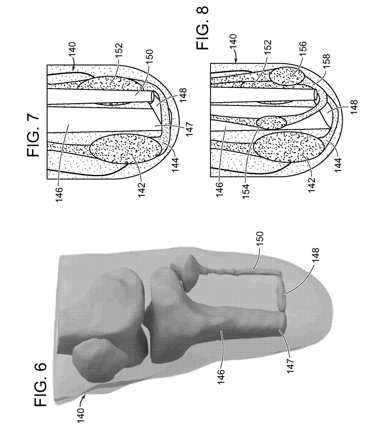 Method And System For Providing Proprioceptive Feedback And Functionality Mitigating Limb Pathology