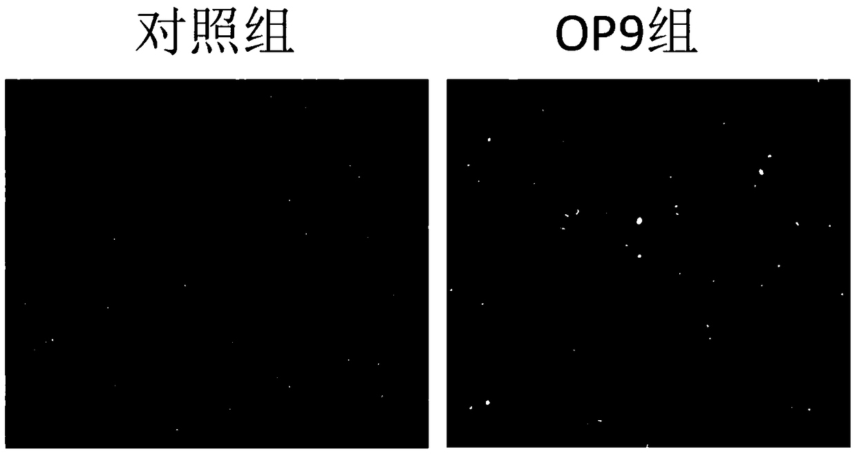 A kind of in vitro culture method of primary B-cell acute lymphoblastic leukemia cells