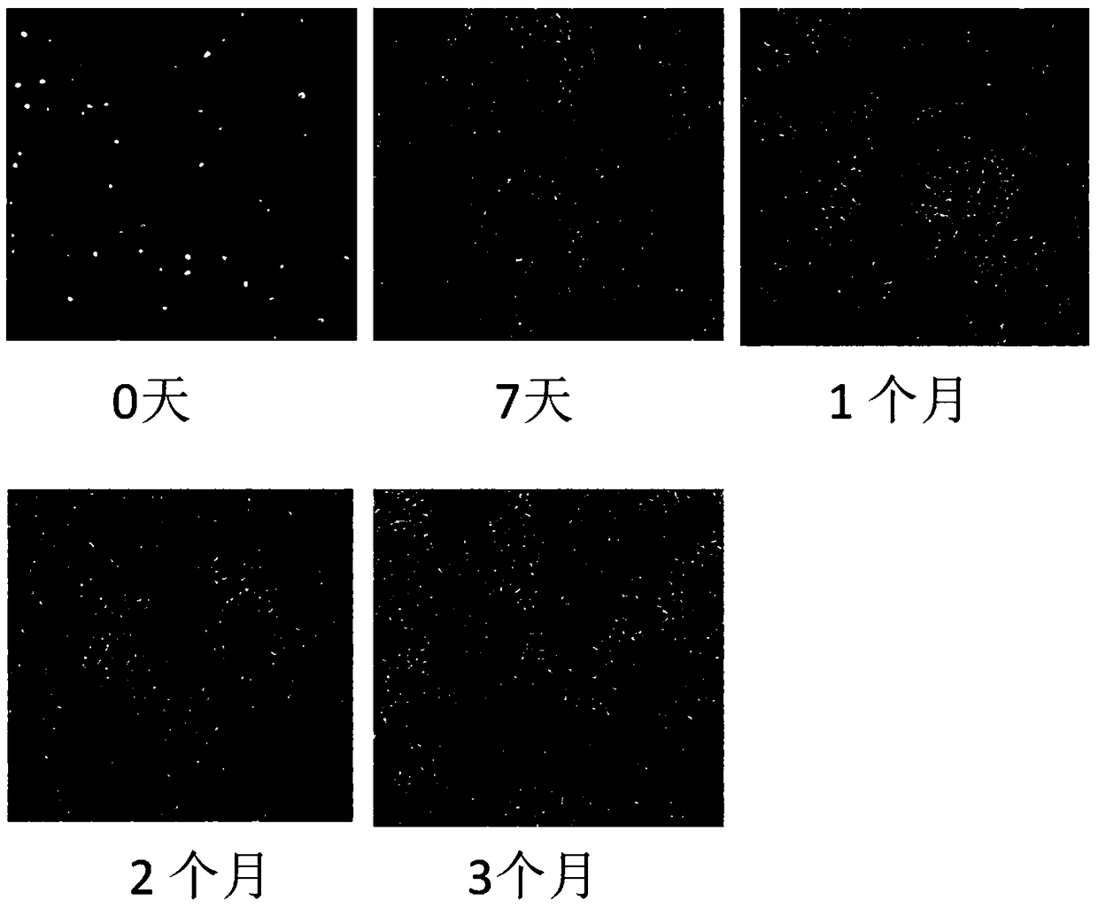 A kind of in vitro culture method of primary B-cell acute lymphoblastic leukemia cells