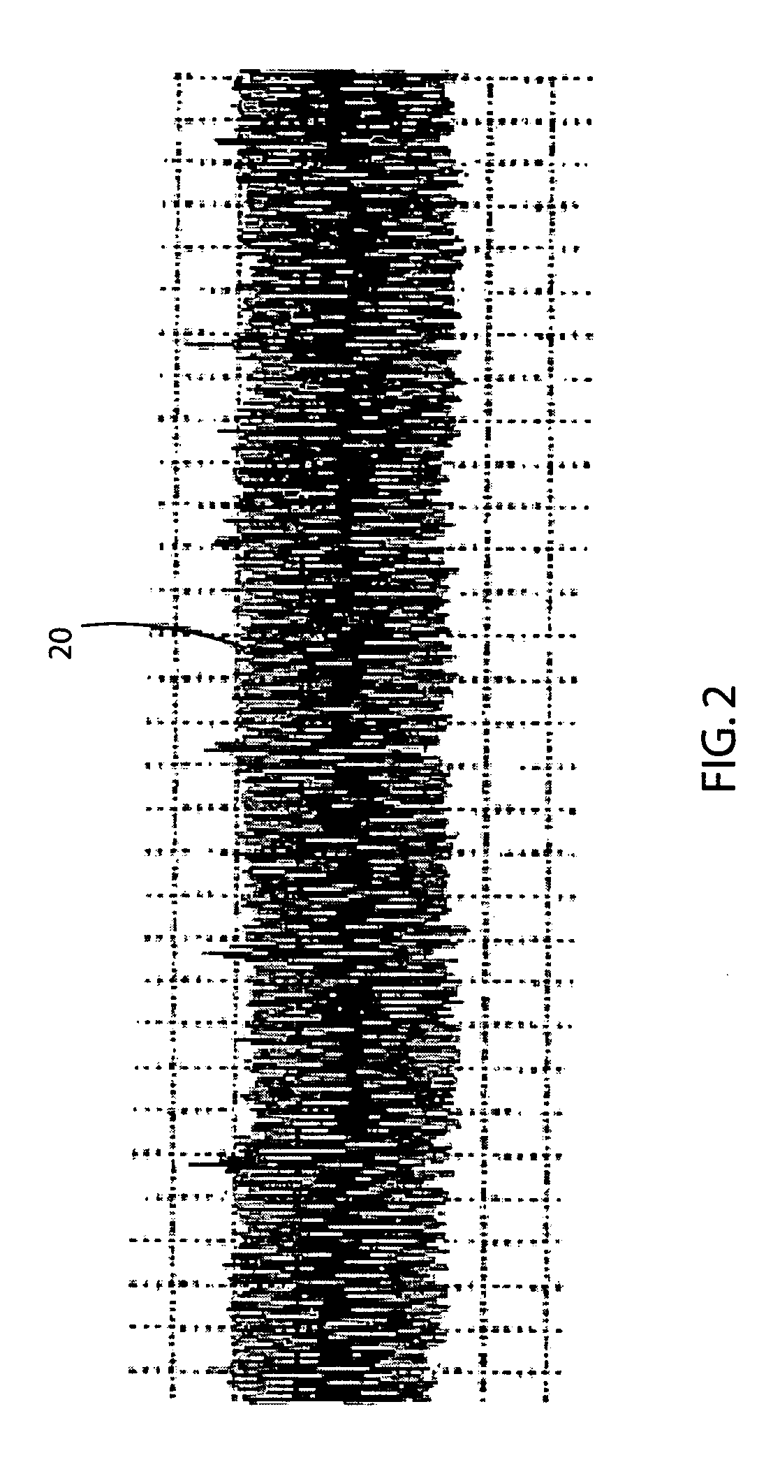 Apparatus and method for obtaining cardiac data