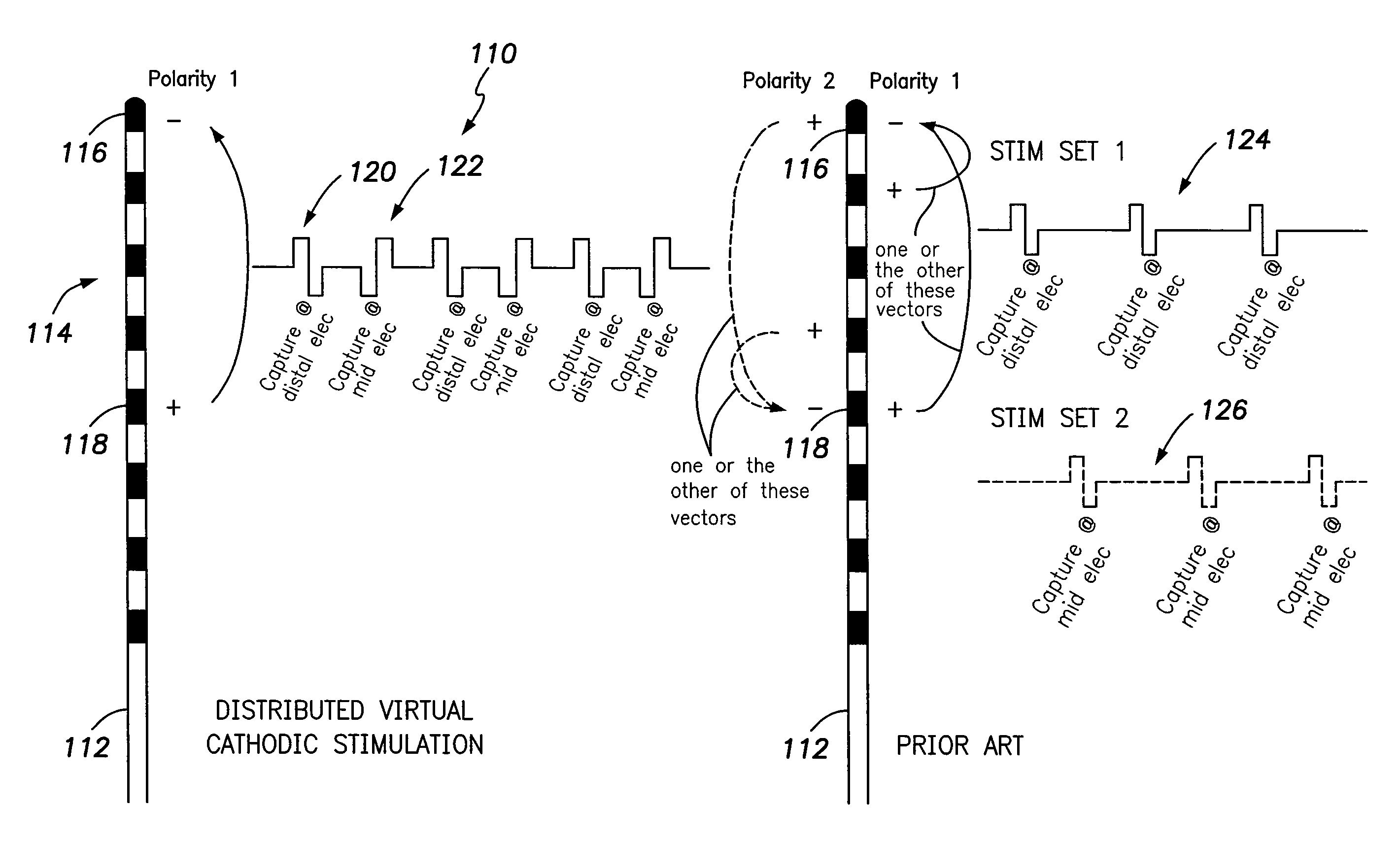 Systems and methods for providing a distributed virtual stimulation cathode for use with an implantable neurostimulation system