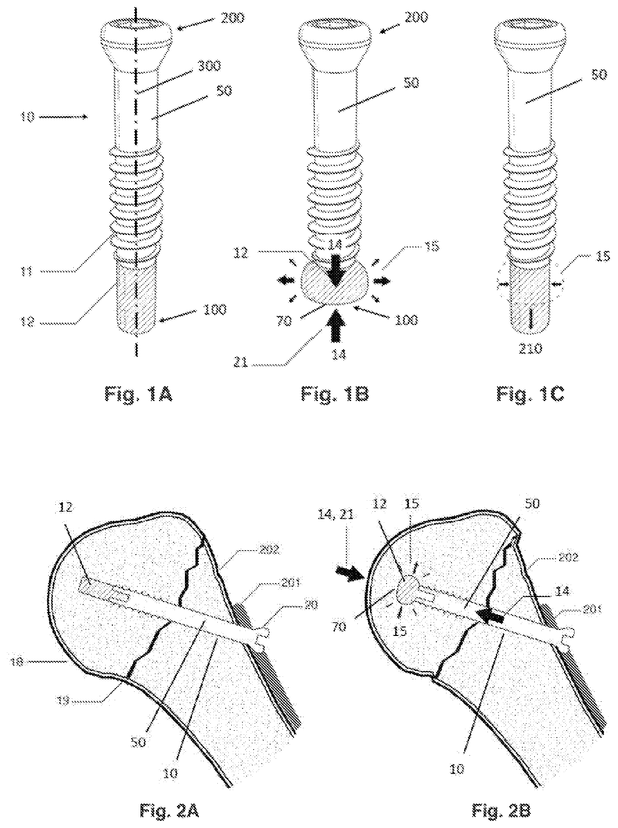Anti-penetration bone implant device and method