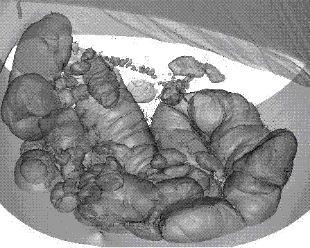 Method for carrying out three-dimensional reconstruction on intestinal canal by using VTK (Visualization Tool Kit)