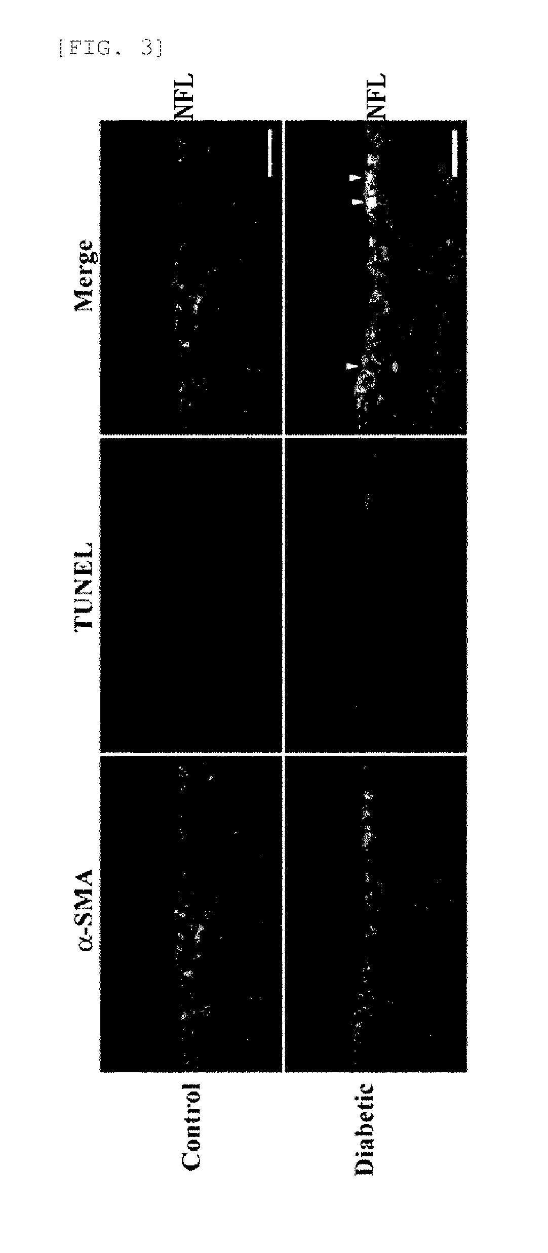 Recombinant adenovirus expressing alpha-a-crystallin gene and gene therapy for retinalvascular disease using the same