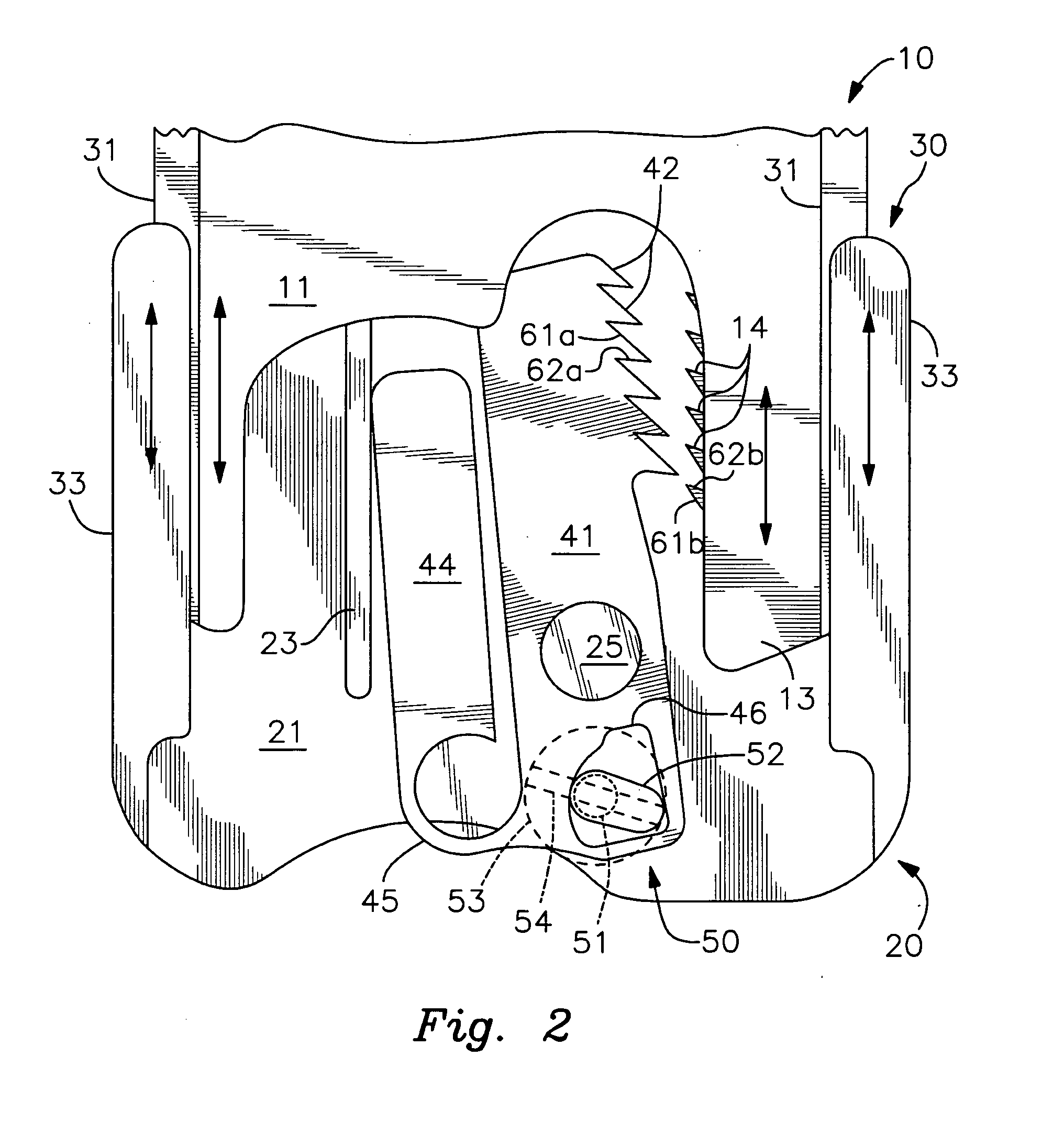 Lock and release mechanism for a sternal clamp