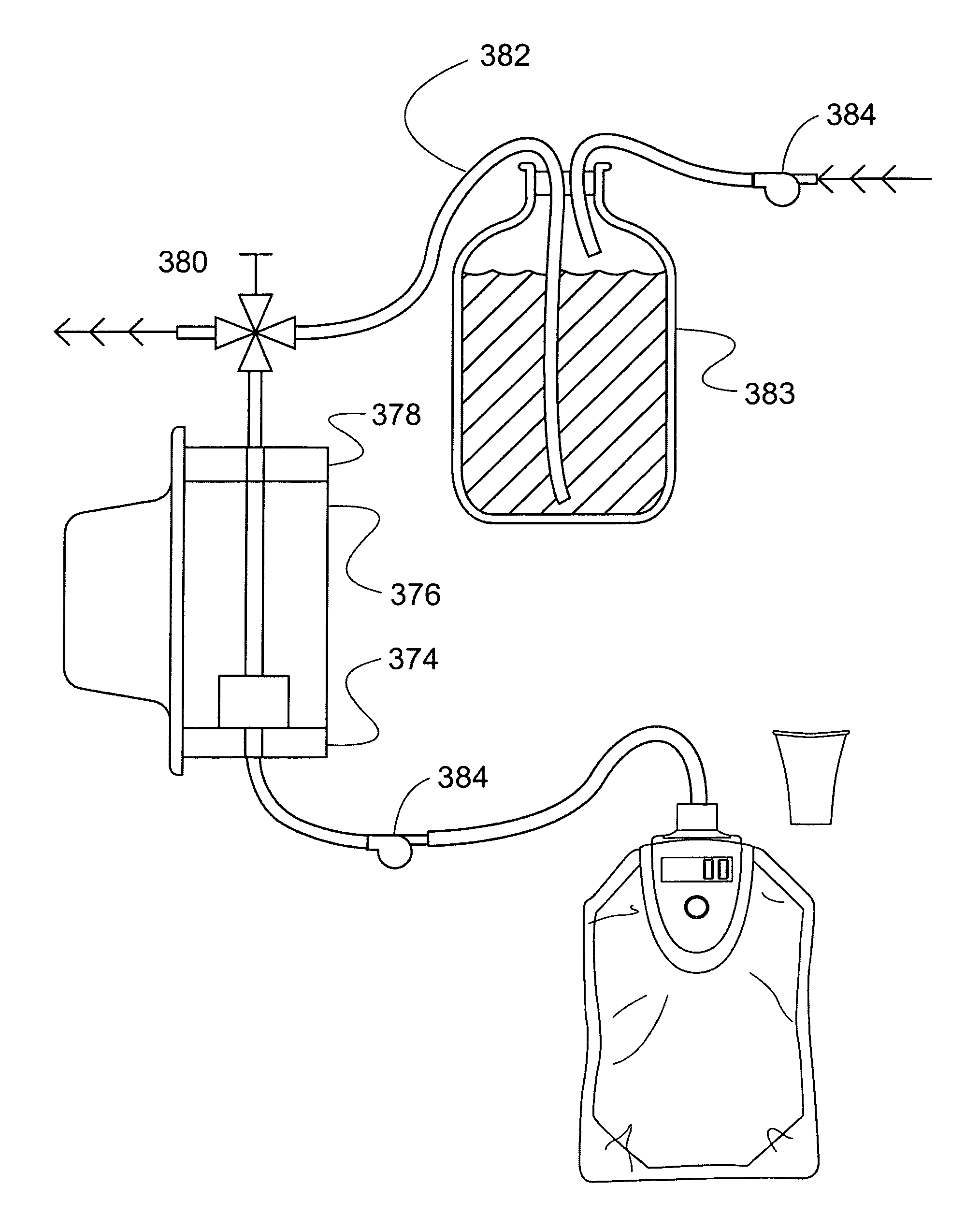 Method and apparatus for analyzing acetone in breath