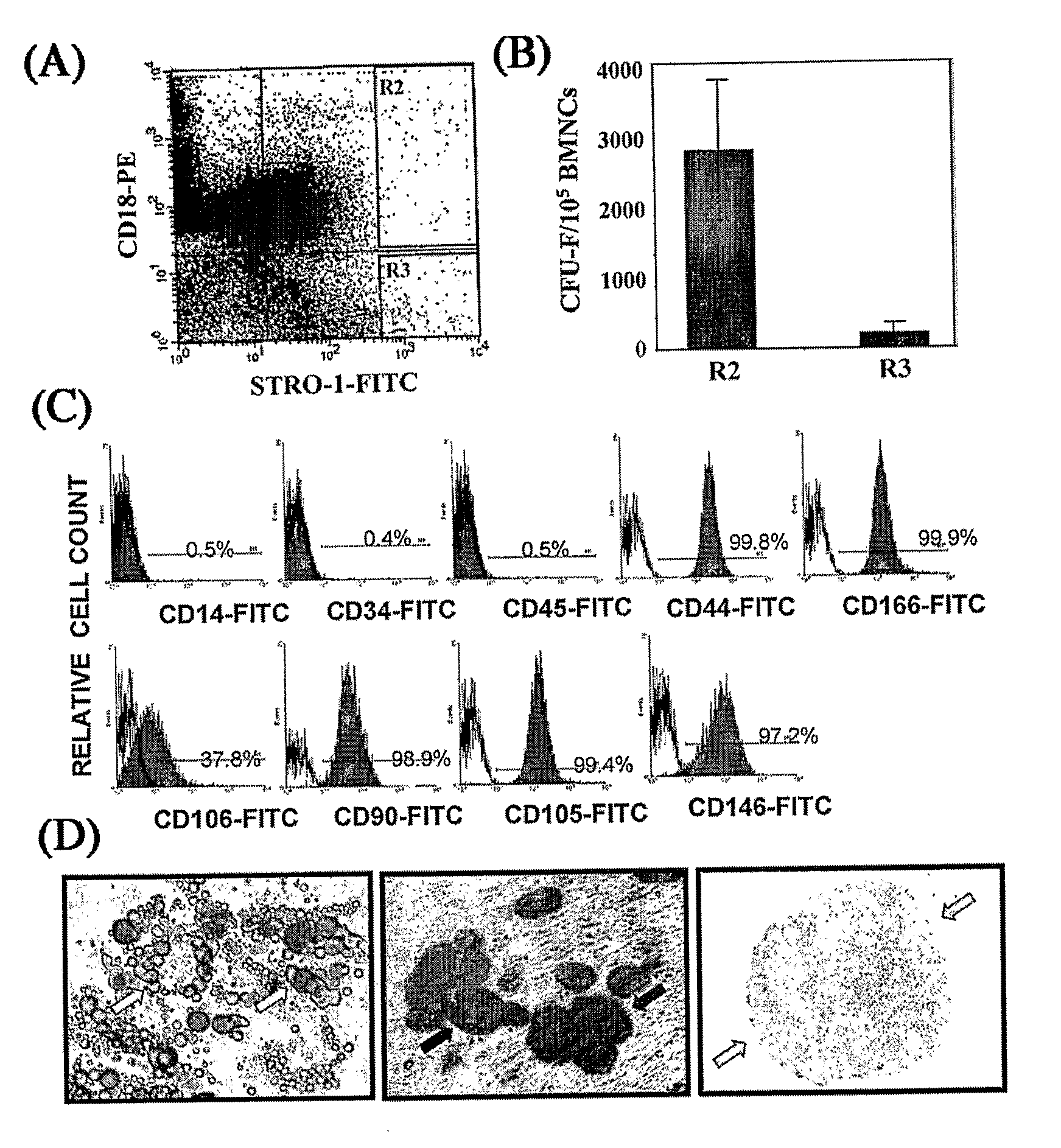 Integrin CD18 is a novel stromal stem cell marker and functions to promote osteogenesis