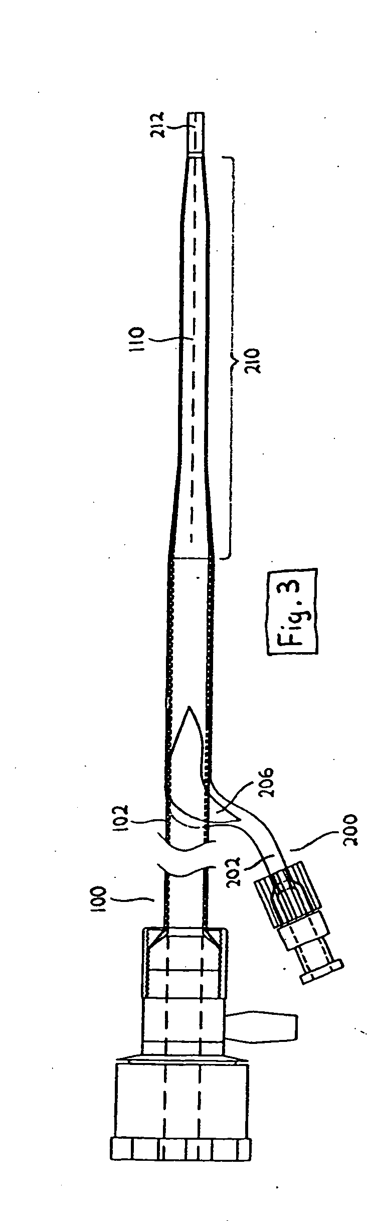 Expandable percutaneous sheath