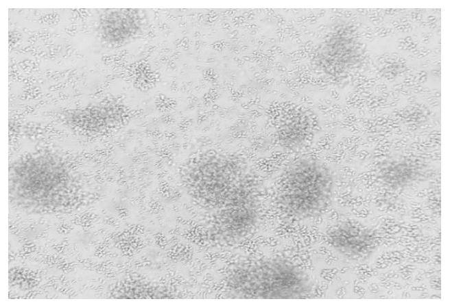 Reagent and reagent kit for in vitro culture of NK cells through union of dual antibodies and thymosin, and culture method