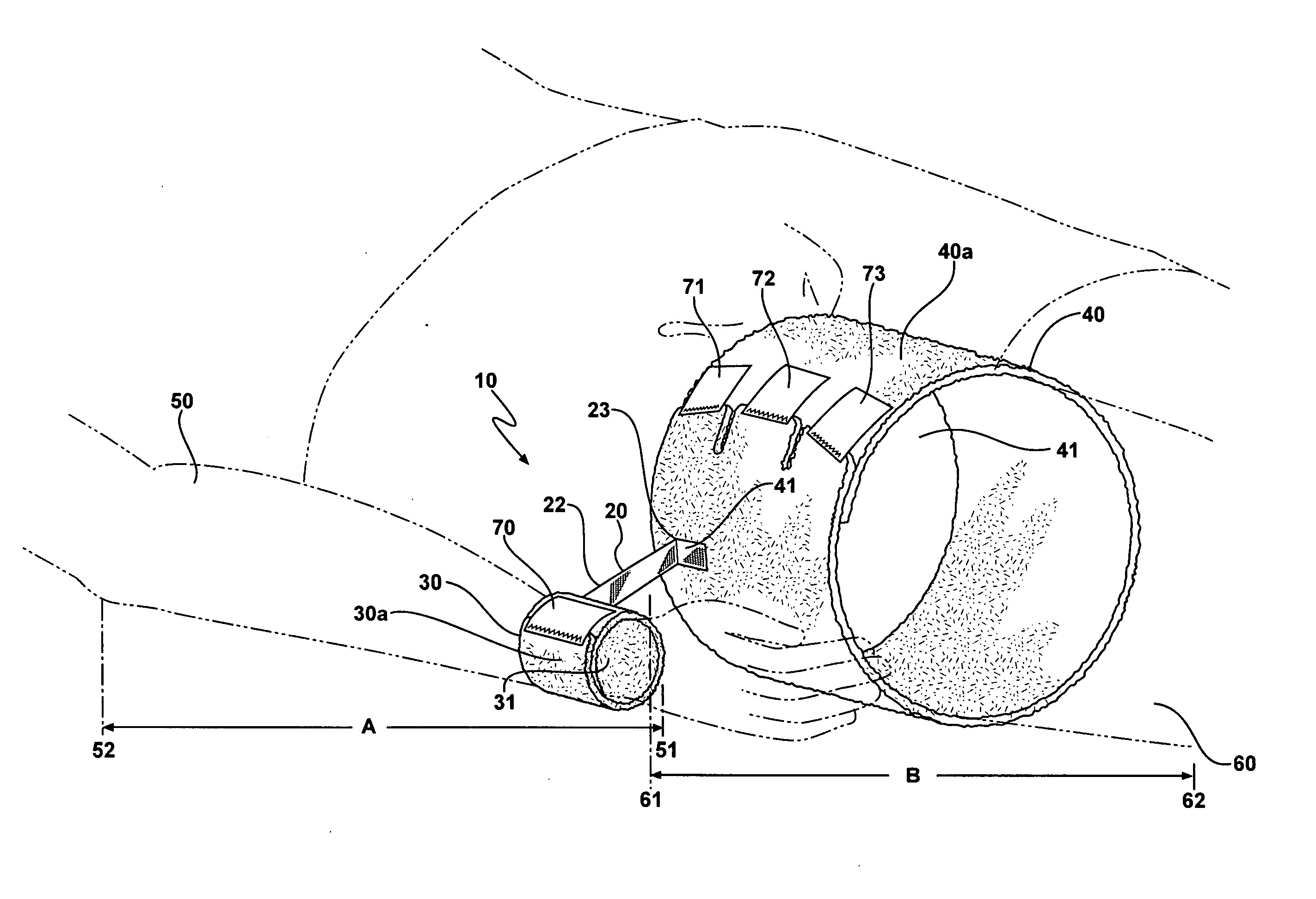 Orthopedic restraint and method for shoulder remediation