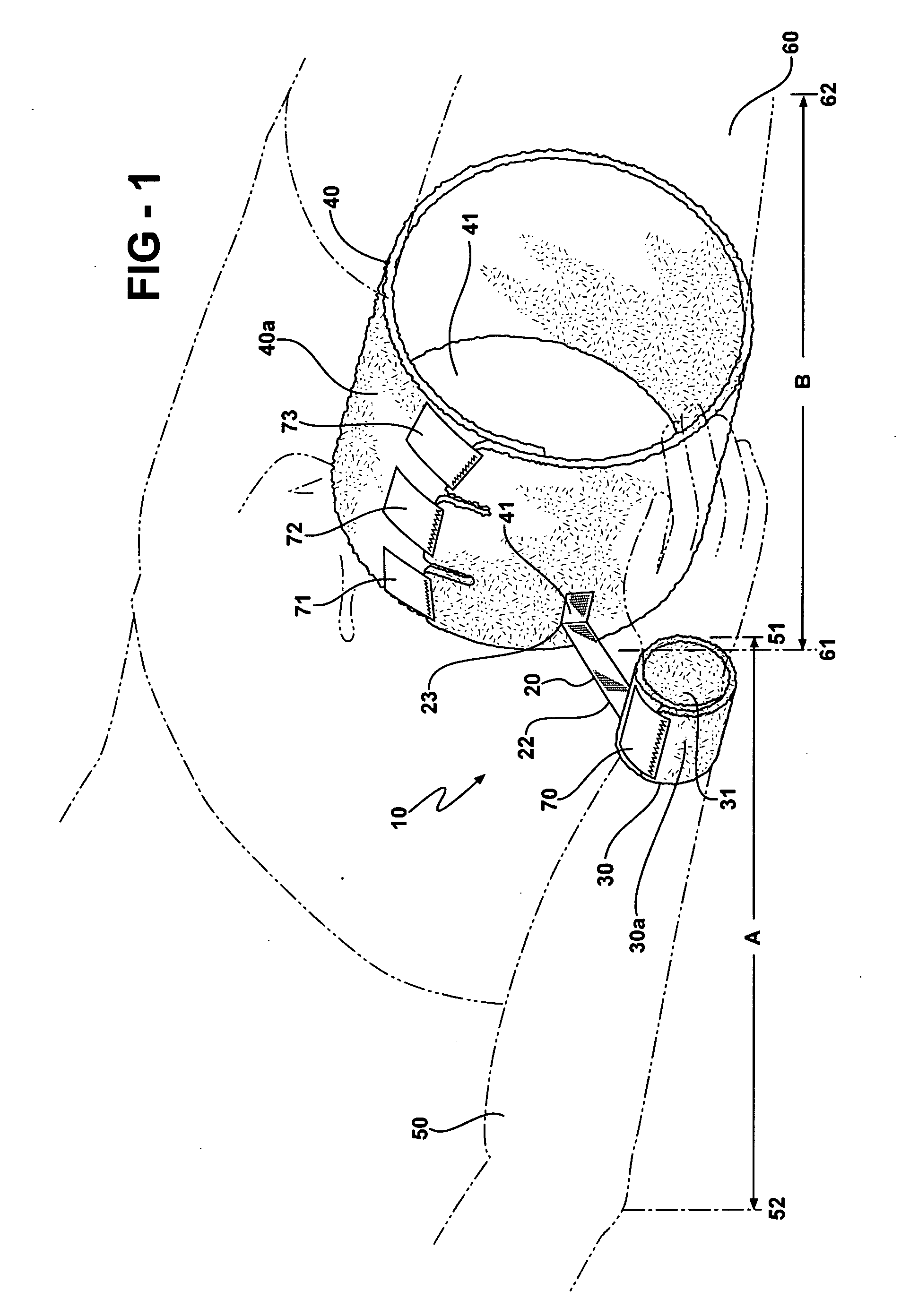 Orthopedic restraint and method for shoulder remediation