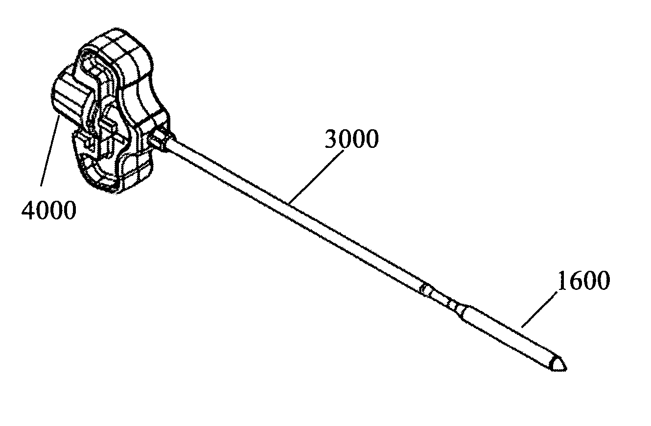 Expandable intramedullary nail for small bone fixation