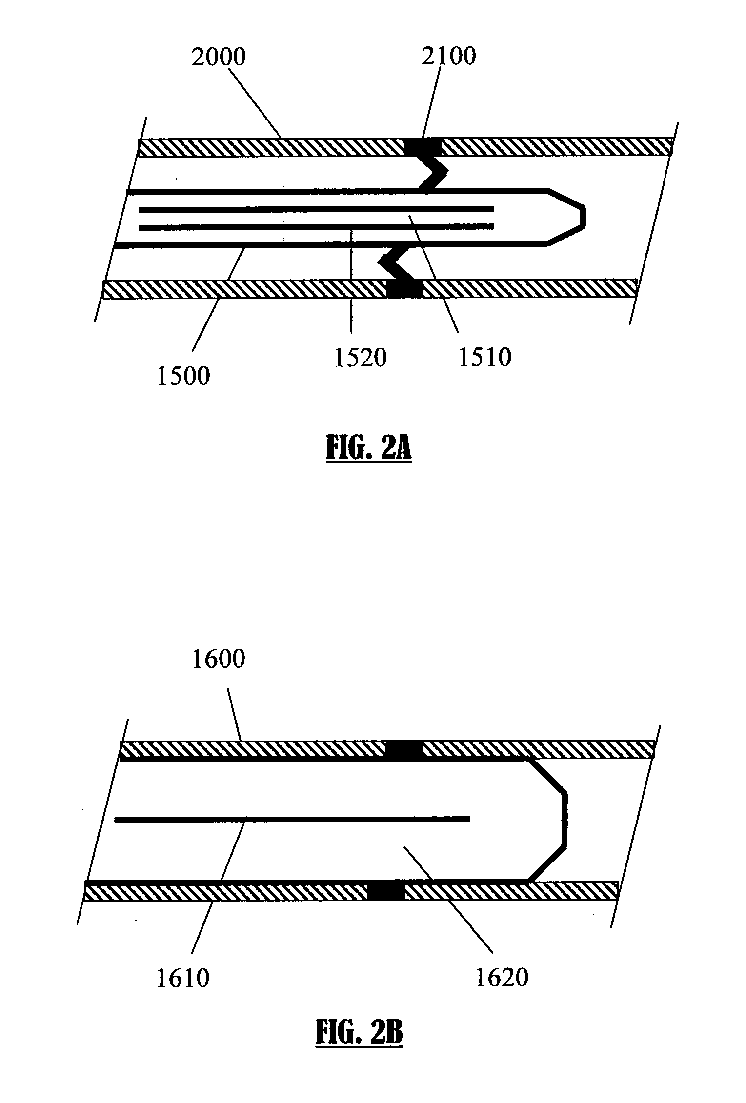 Expandable intramedullary nail for small bone fixation